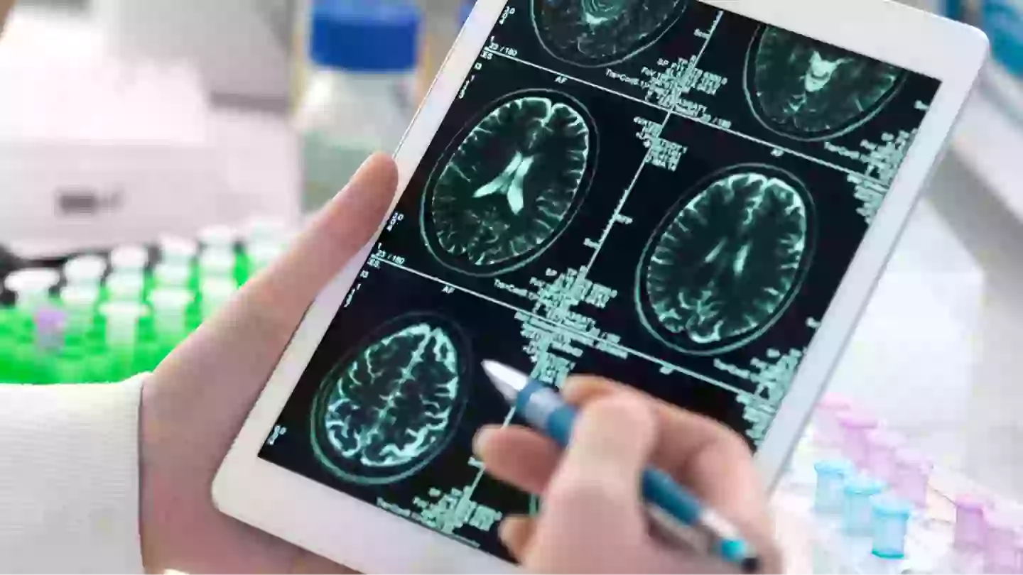 Study finds that eating one common 'superfood' could cut Alzheimer's disease risk by almost 50%