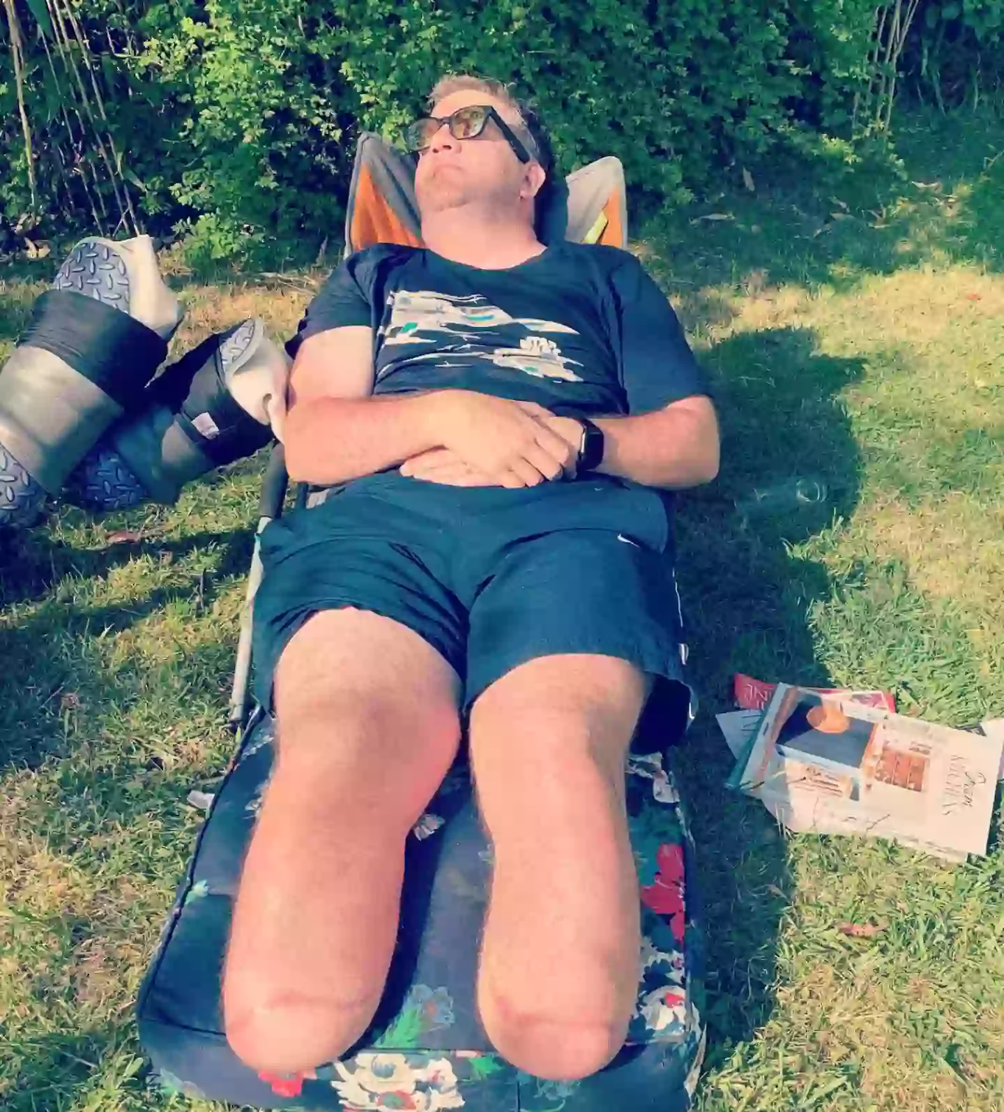 The former NHS surgeon had carried hundreds of amputations on others (bionicsurgeon/Instagram)