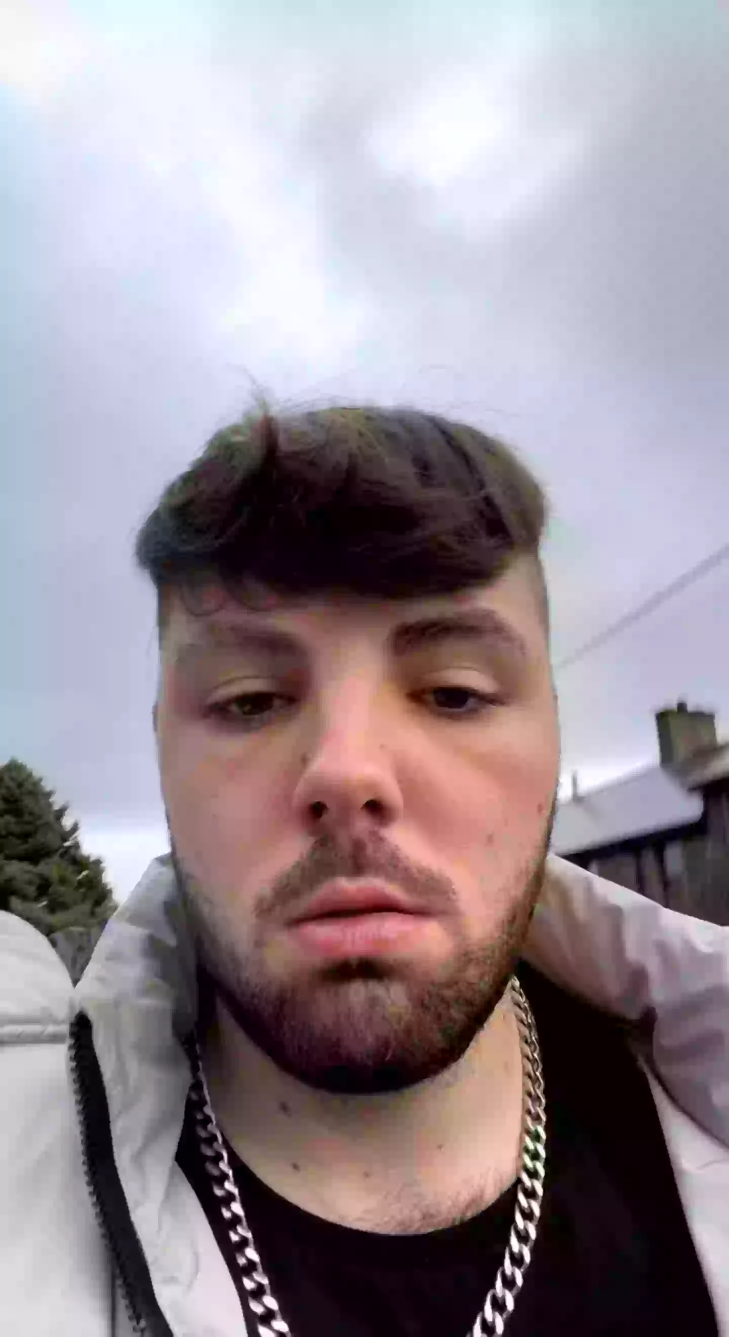 The influencer originally feared he'd contracted a sexually transmitted infection (SWNS)