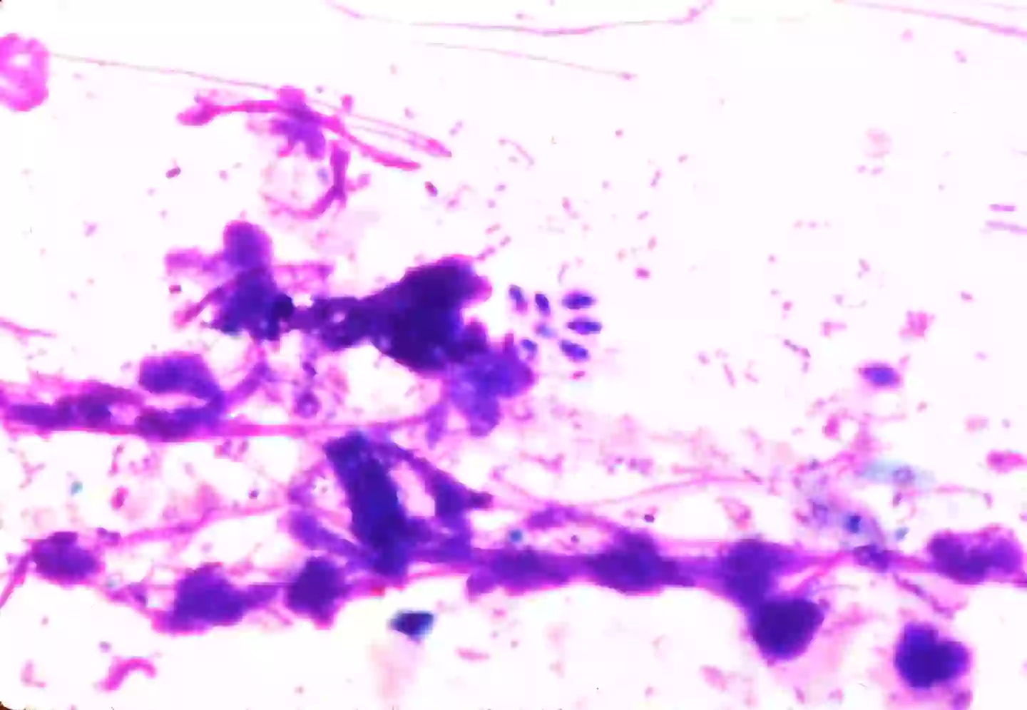 The toxin can lie dormant for years (Getty Stock Photo)