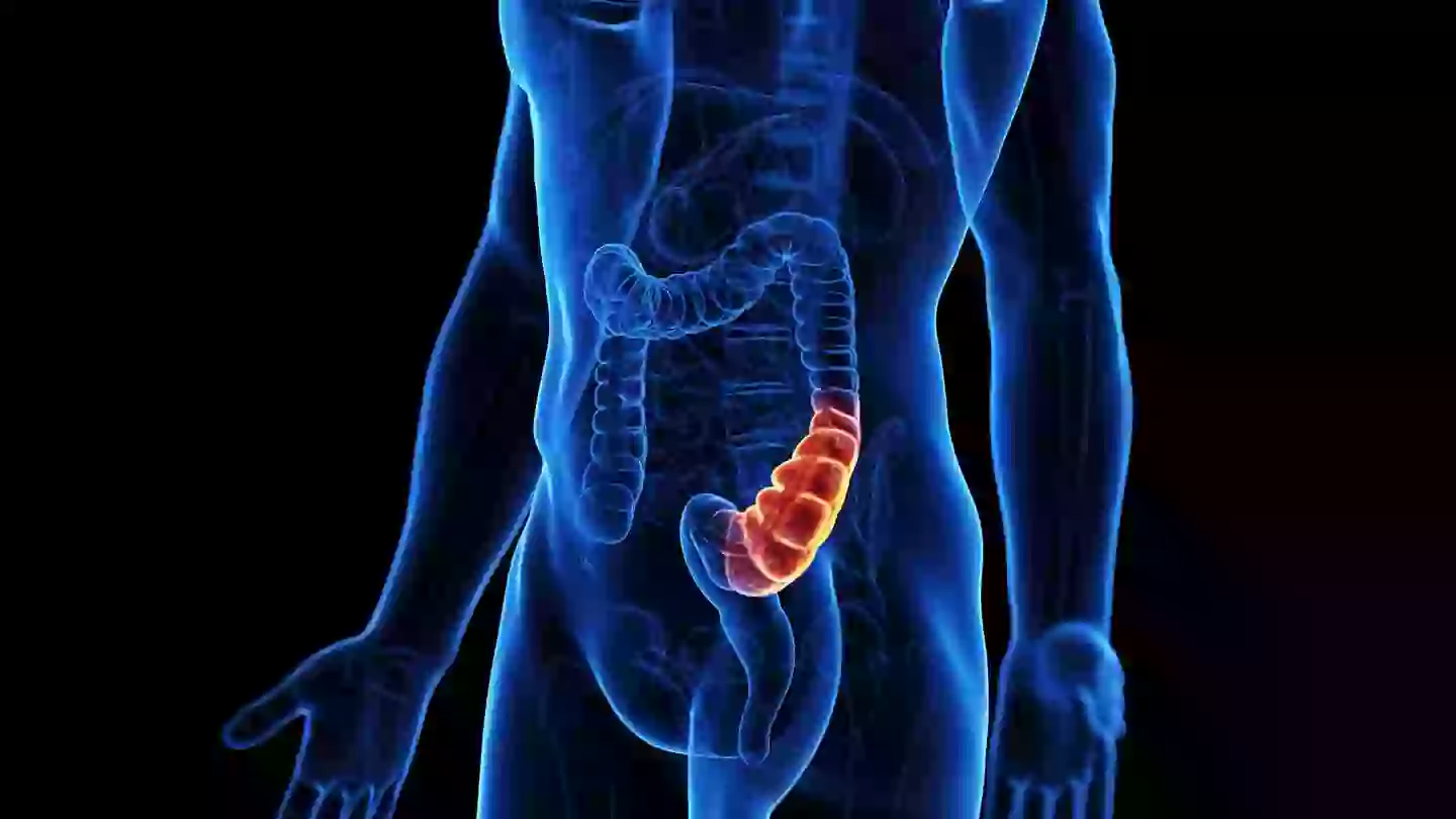Signs of colorectal cancer can include blood in your stool (Getty Stock Photo)