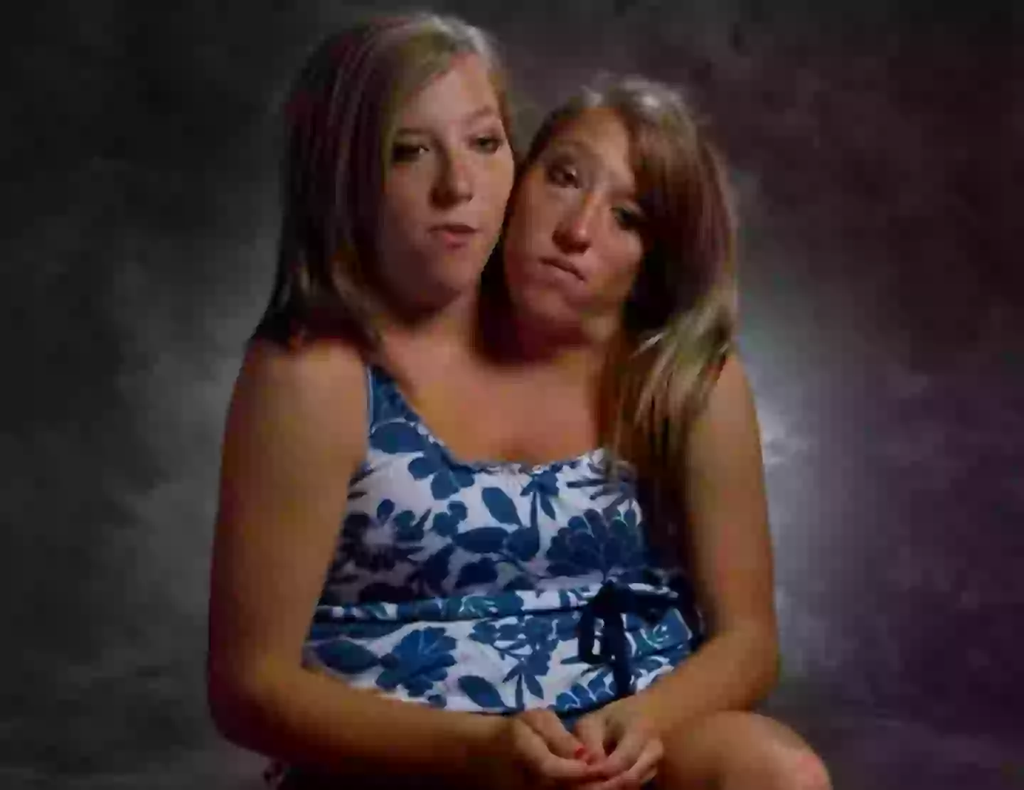 Abby and Brittany Hensel are conjoined twins (YouTube/OMG Stories)