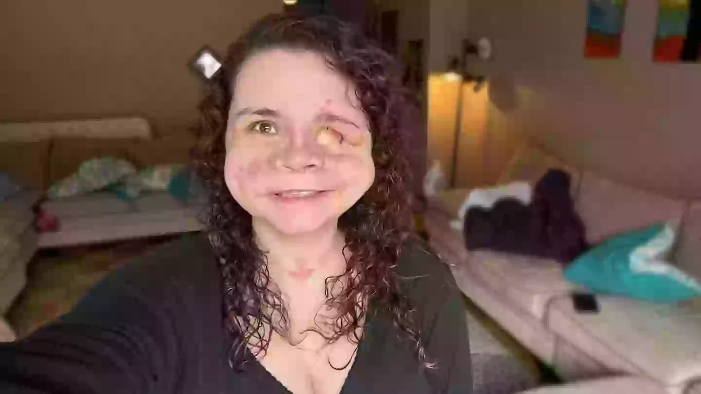 Woman given ‘less than 2%’ chance of survival after being shot in the face shares important message about horrific trauma