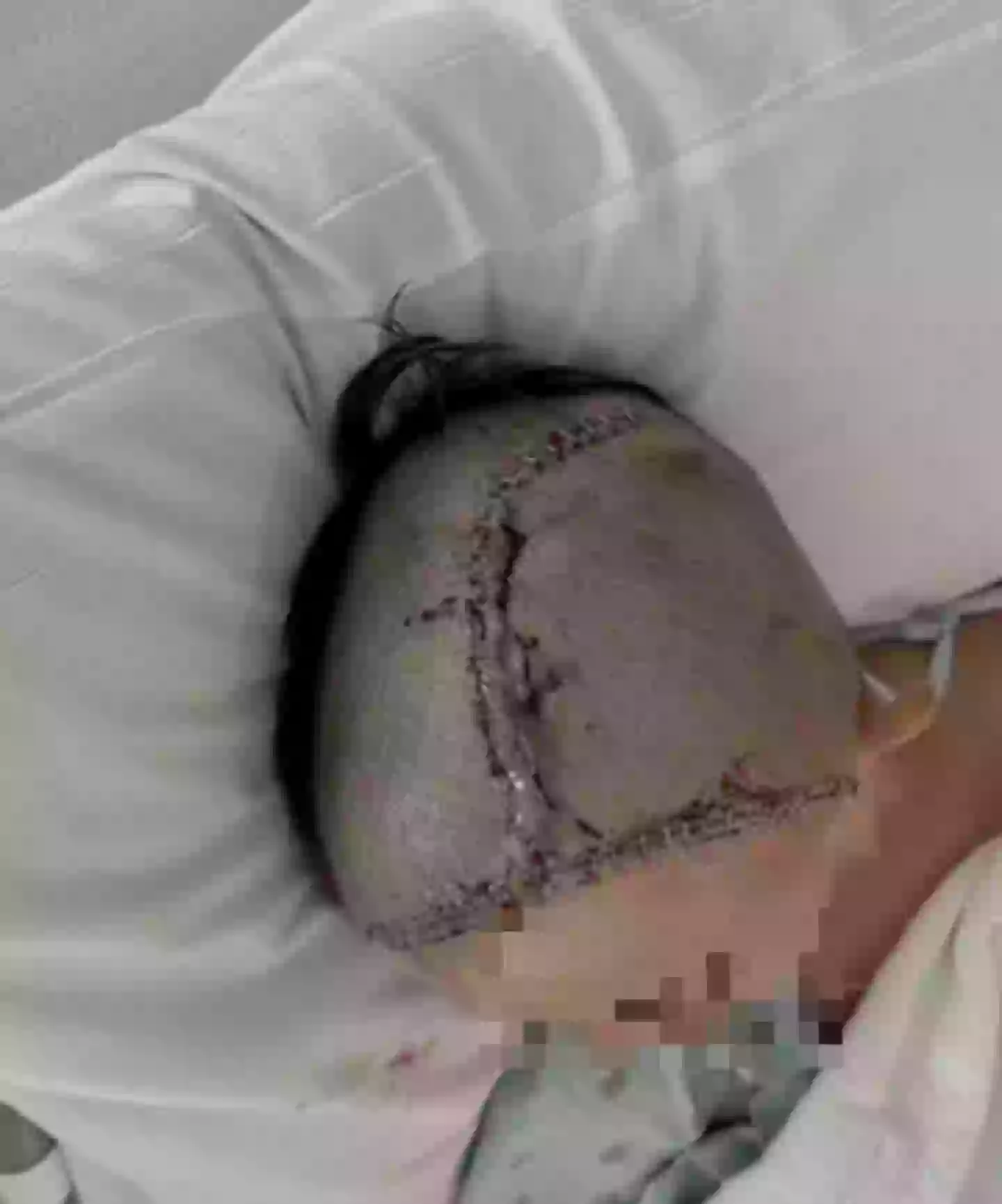 The 14-year-old teenager was allegedly attacked in his school cafeteria (KBTX)