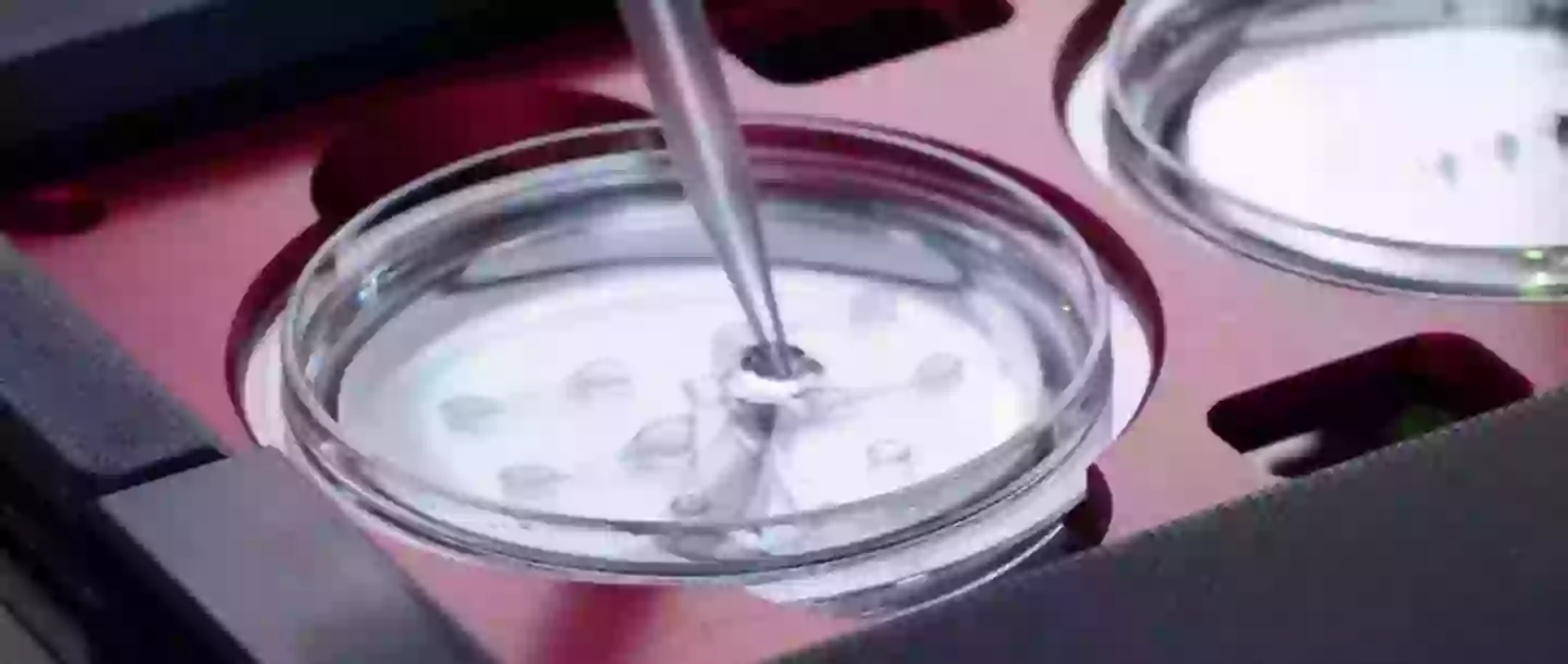 Conceivable Life Sciences has automated the ICSI process (Conceivable Life Sciences)