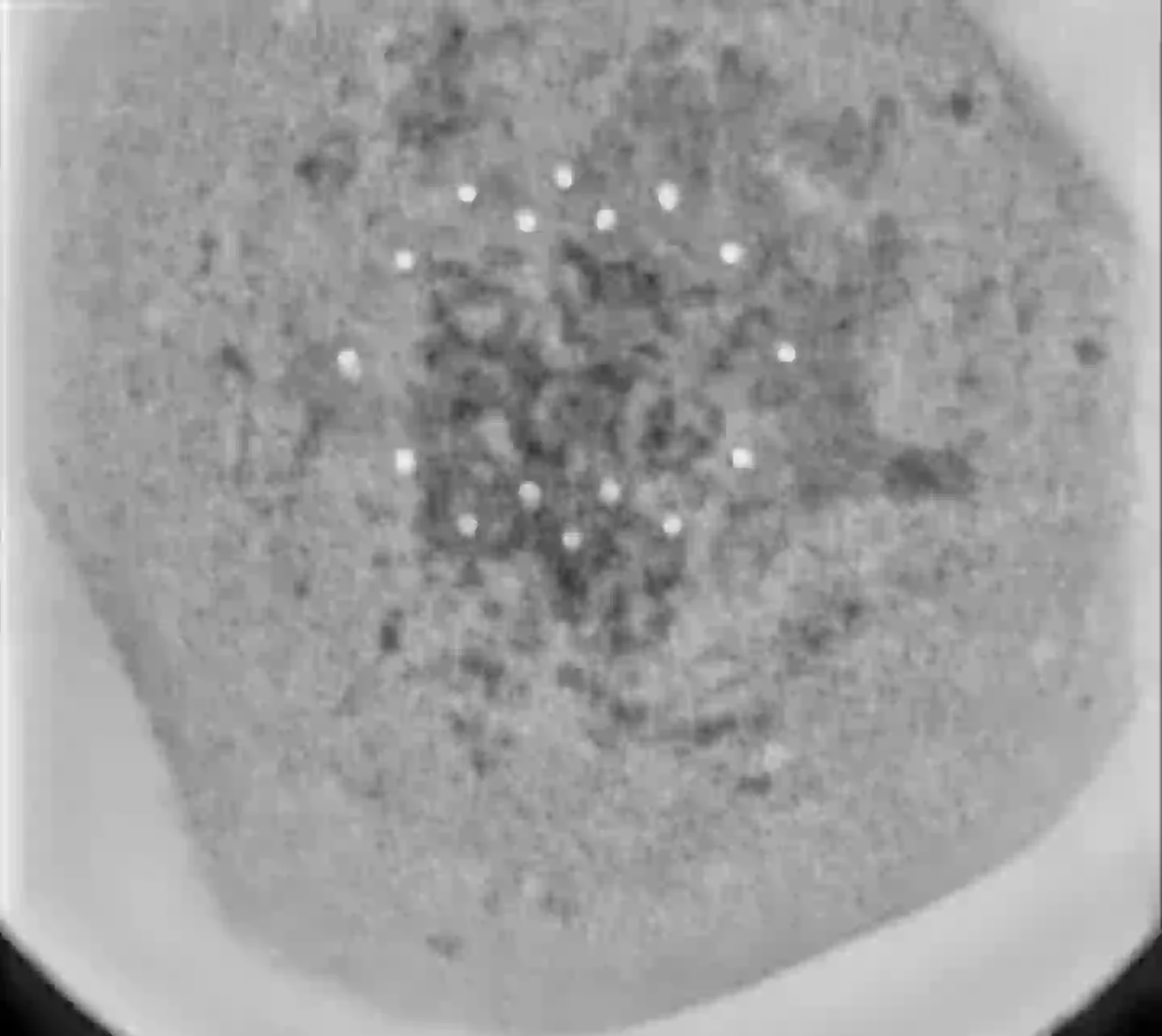 X-rays of the strange UFO-like sphere reveal 18 non-random 'microspheres' linked to a central 'chip' (X/@truthpolex)