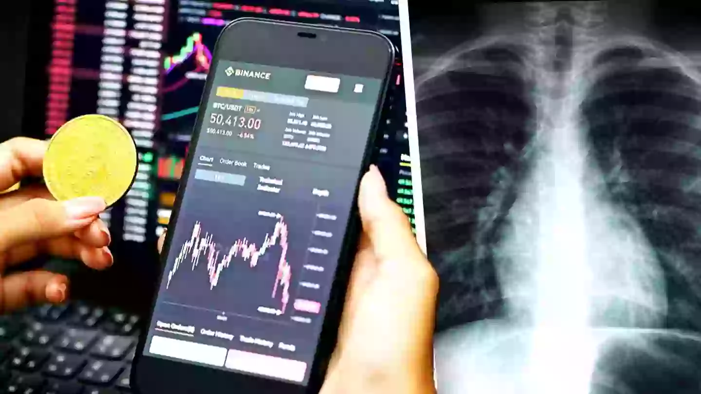 French Surgeon Attempts To Sell Terrorist Victim’s X-Ray As An NFT