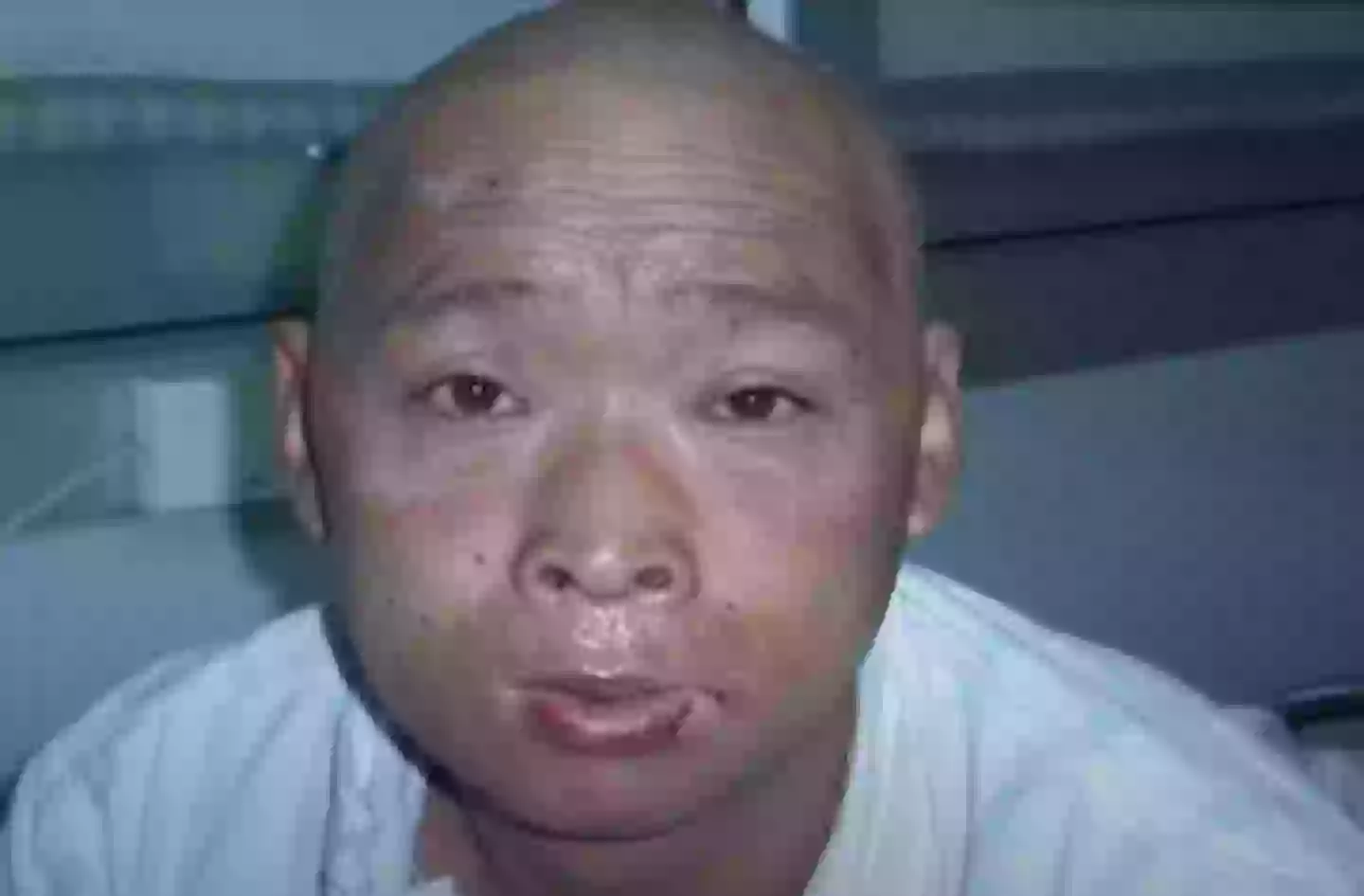 Ouchi as the radiation began to impact his body (YouTube/Peaked Interest)