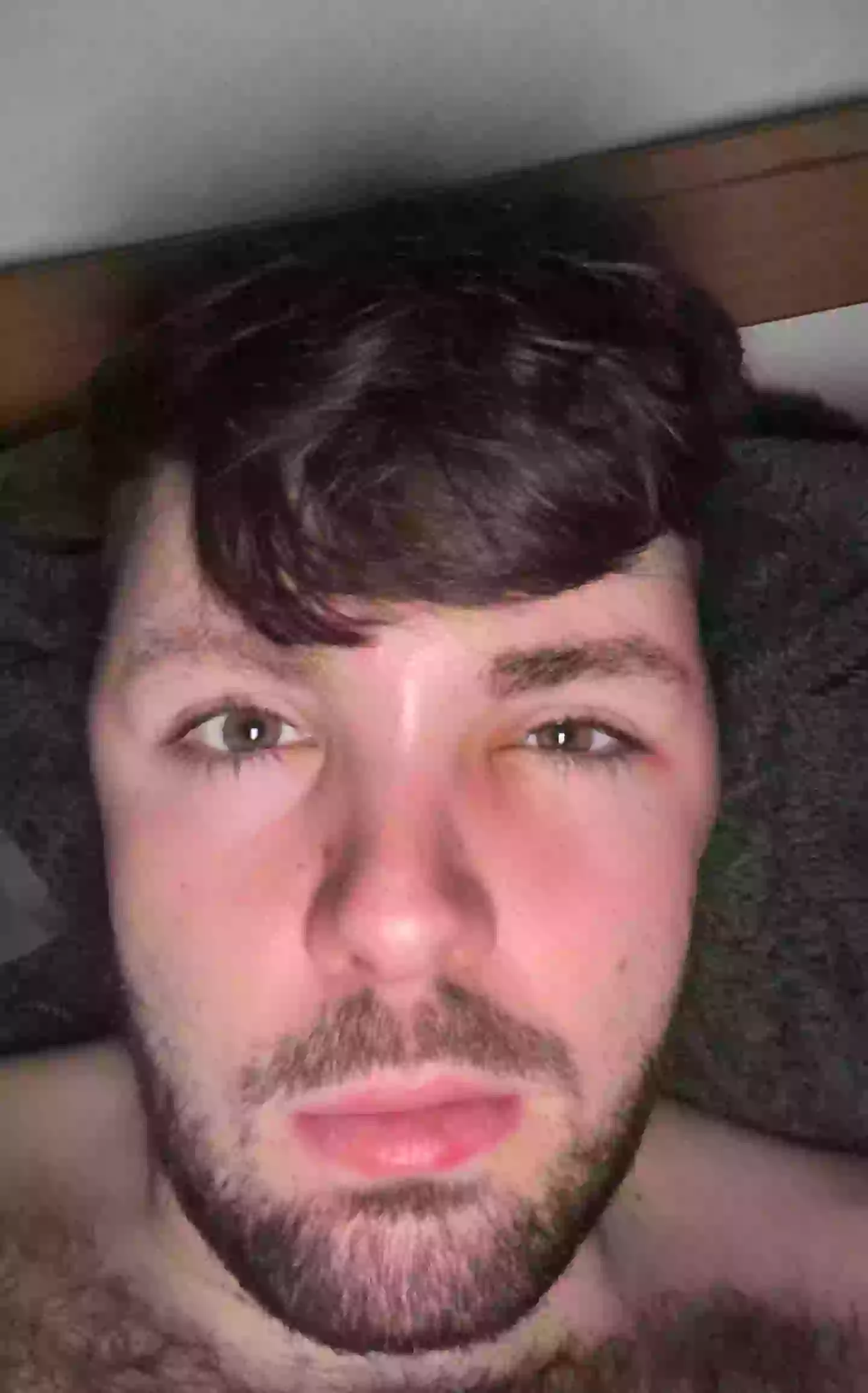 Ruben's swelled head (SWNS)