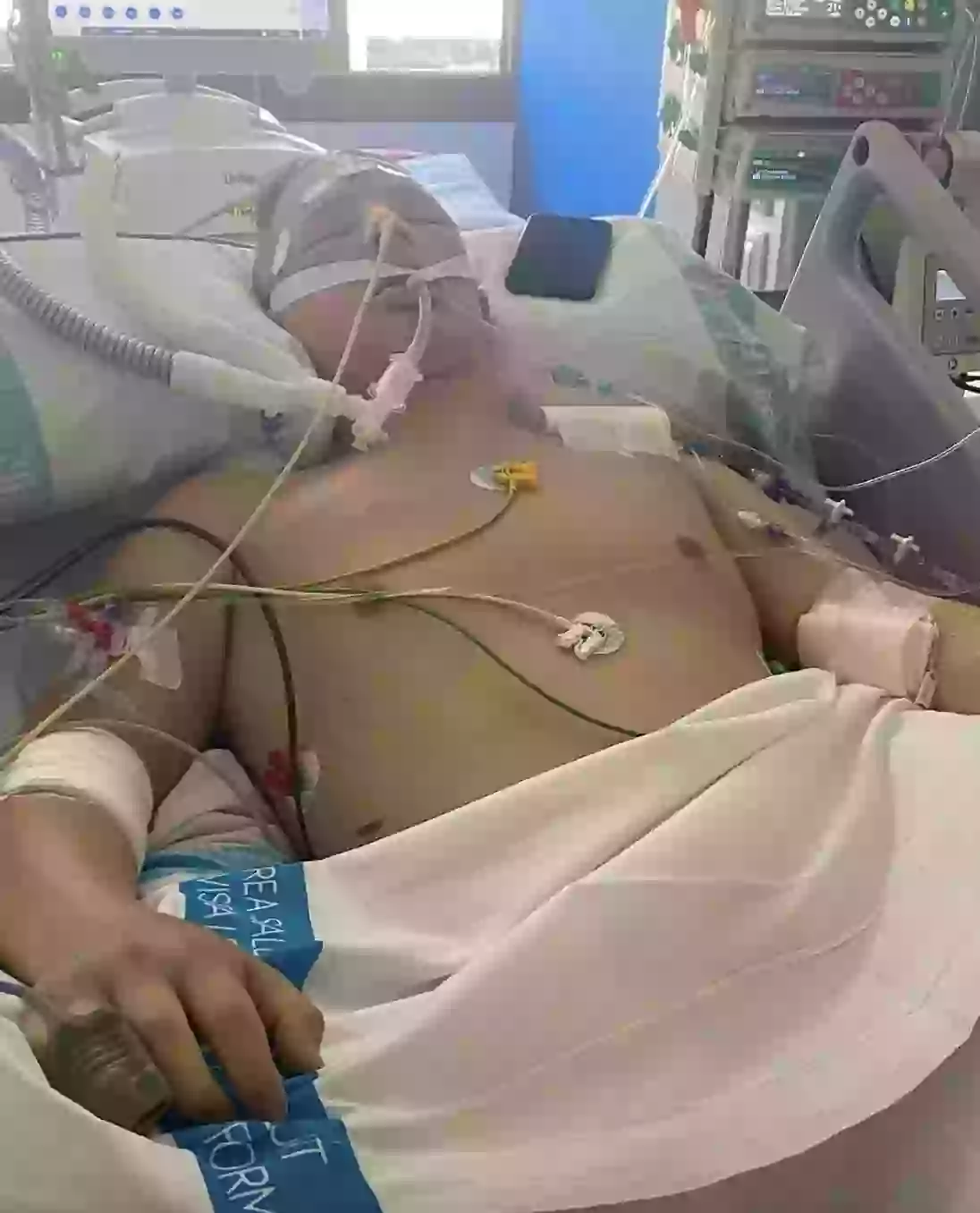 Ryan Long was hospitalised for days after the incident (SWNS)