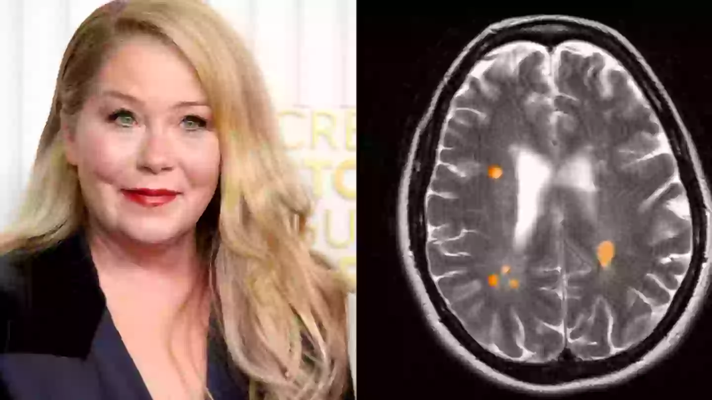 Who is more likely to develop MS as some people are more at risk than others