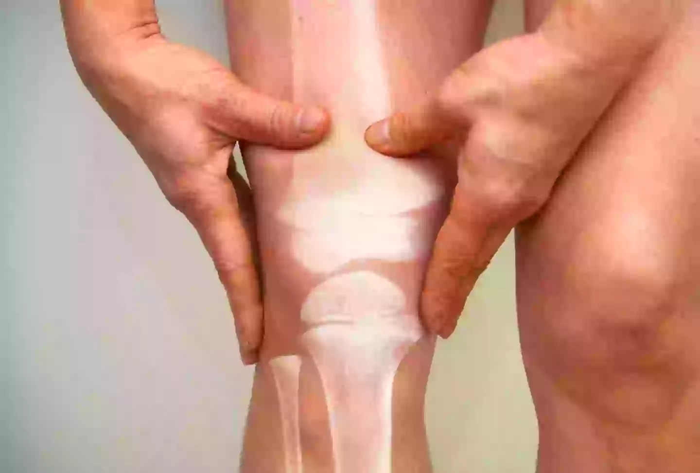 Osteoporosis has been linked to the drugs (Getty Stock Image)