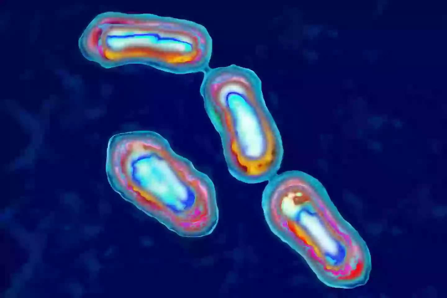 Yersinia Pestis bacteria causes bubonic plague in humans and animals (BSIP/UIG Via Getty Images)