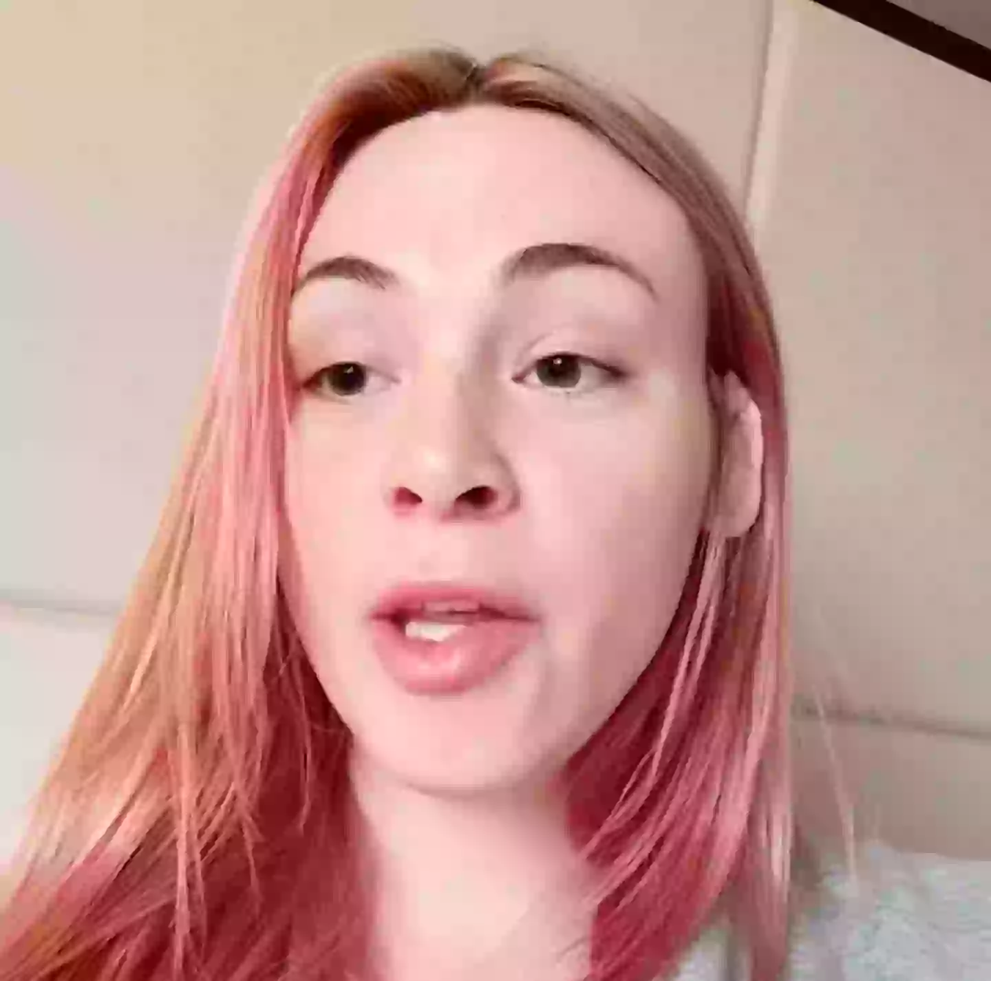 Emily James had six of her ribs removed (EMILY JAMES / CATERS NEWS)