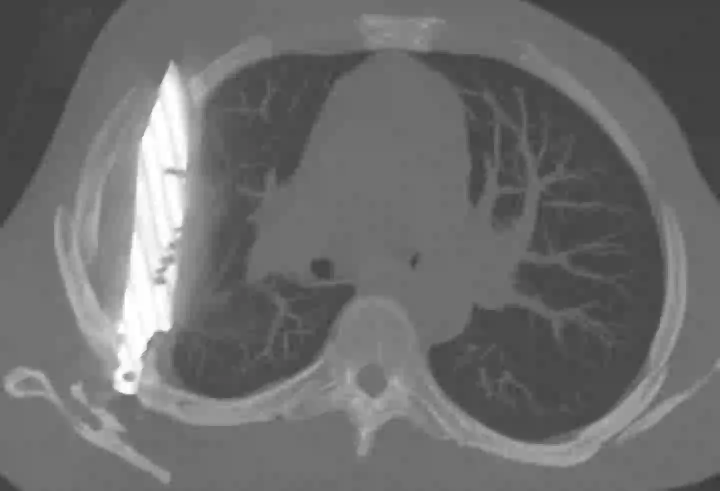 It's a yikes from me (National Library of Medicine)