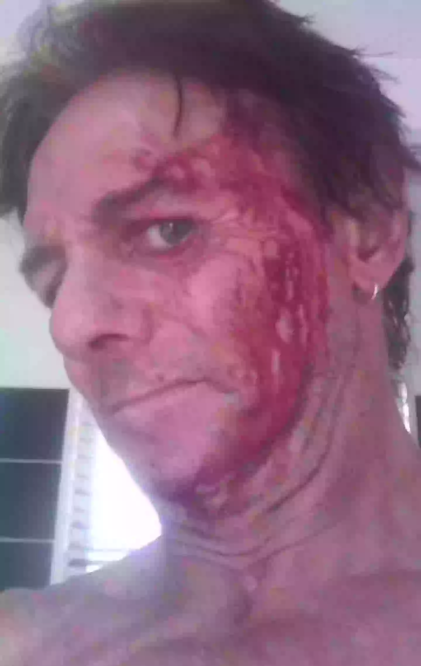 Adrian Stock had a run-in with a monster kangaroo seven years ago (Kennedy News and Media)