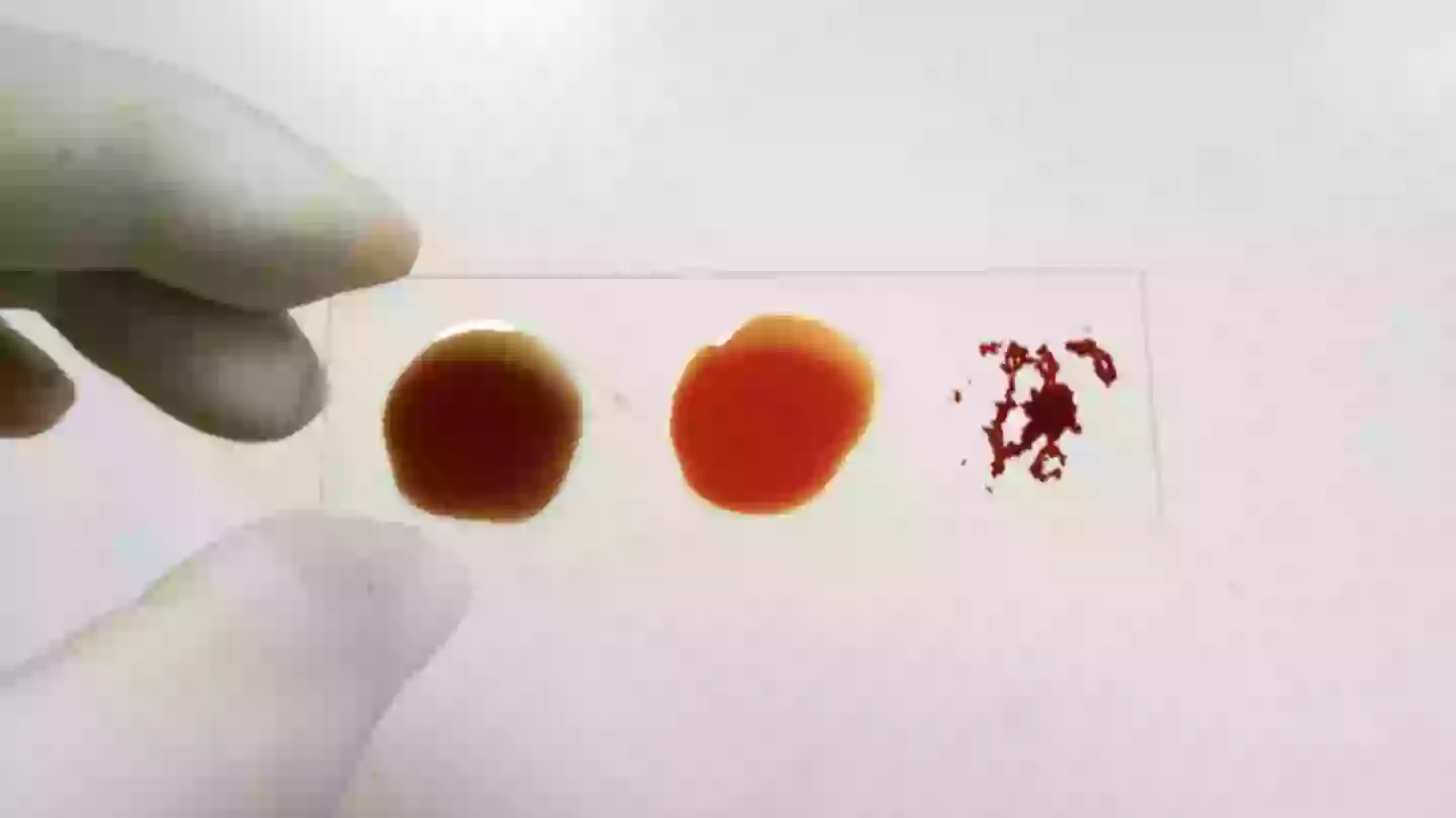 Scientists discover new blood type only found in one woman on earth today