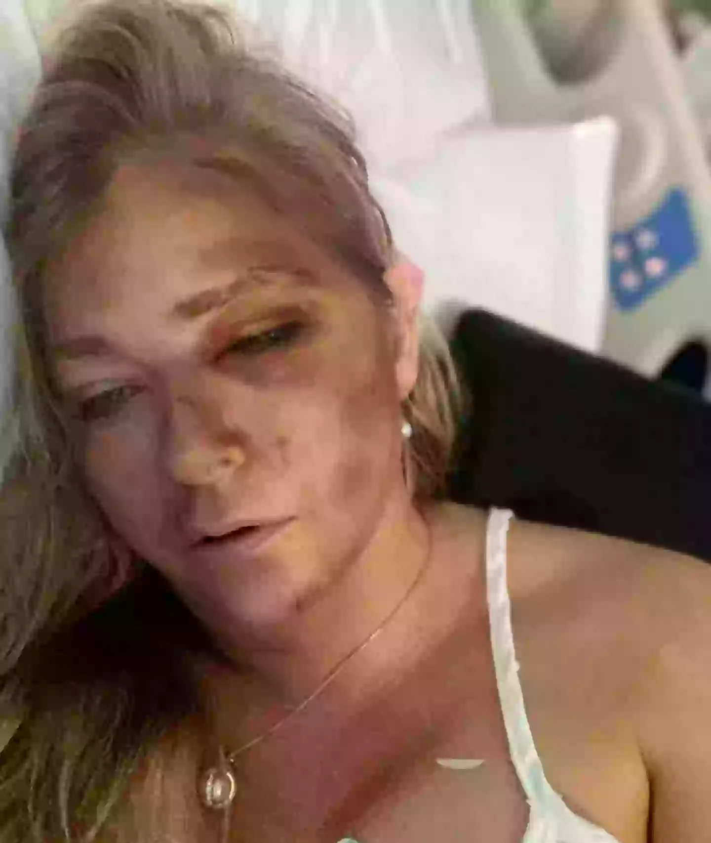 The mum-of-three posted this chilling snap online following her accident (Instagram/@virginiarobertsrising11)