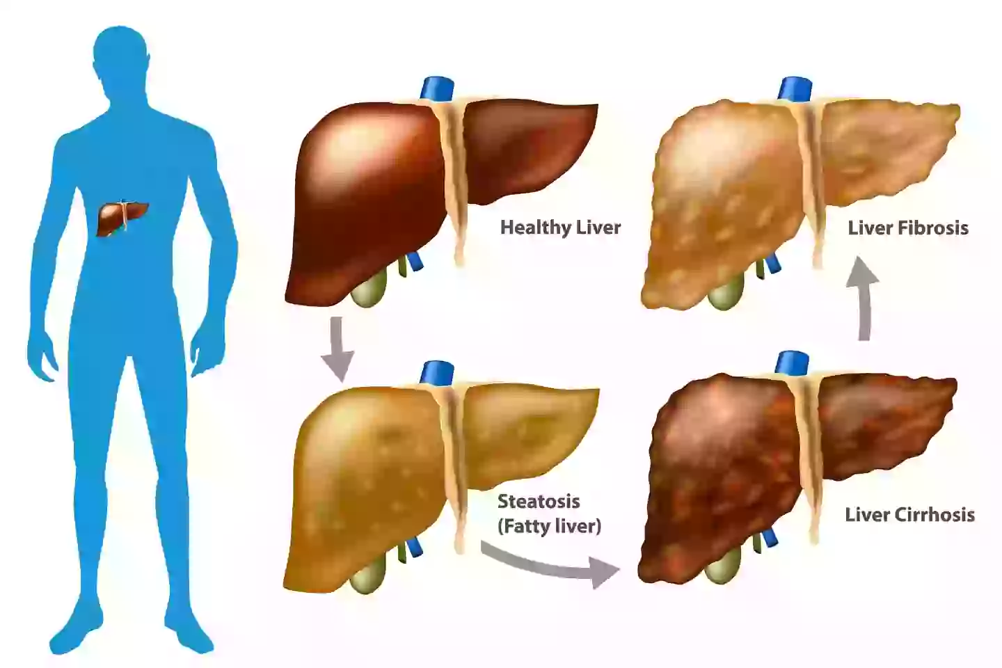 Researchers found boosts to the liver health of the participants (Getty Stock Image)