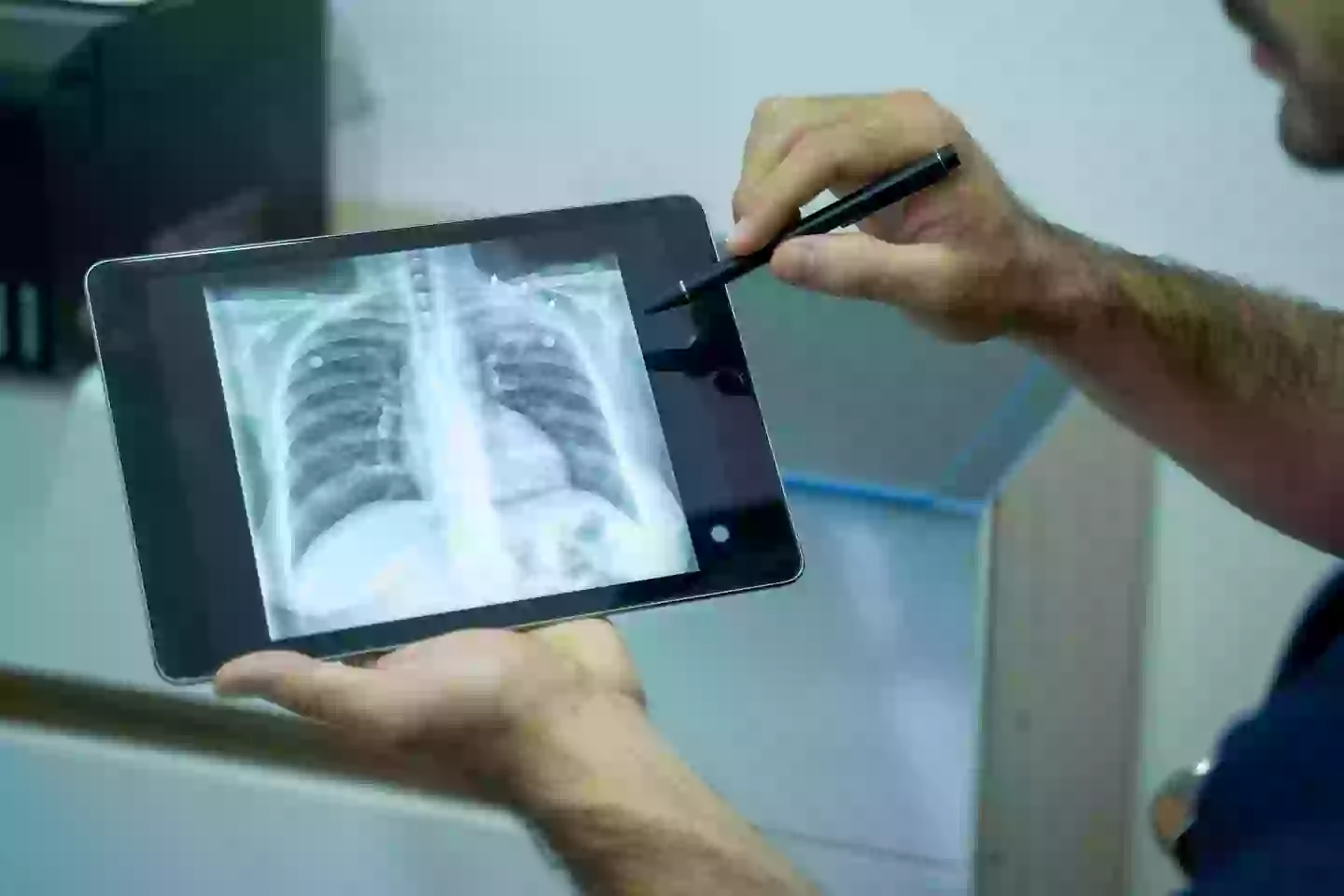 Tuberculosis mainly affects the lungs (Getty Stock Photo)