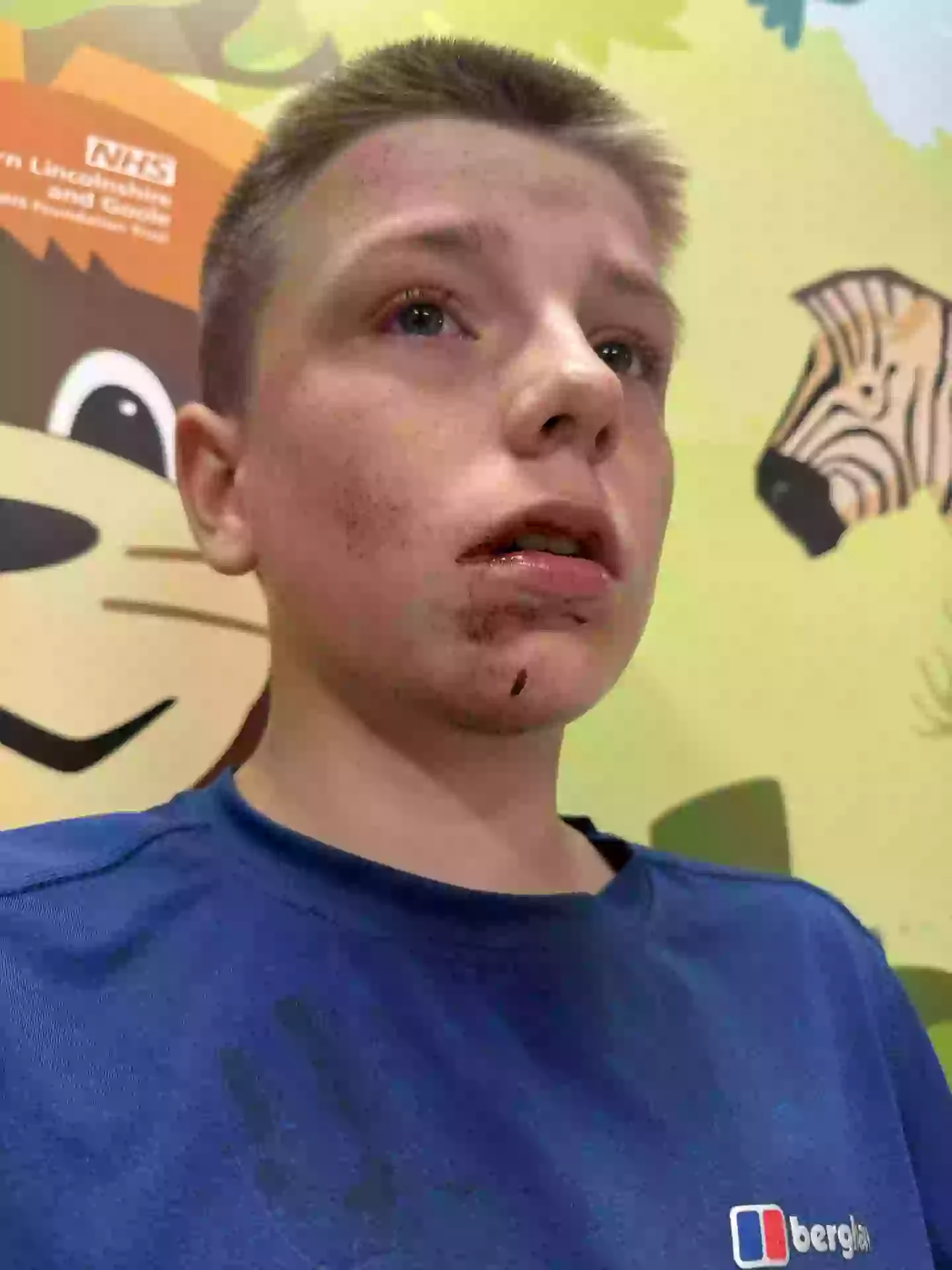 Teenager Lucas passed out for 20 seconds while doing the 'tap out' challenge with friends in a park (Kennedy News and Media)