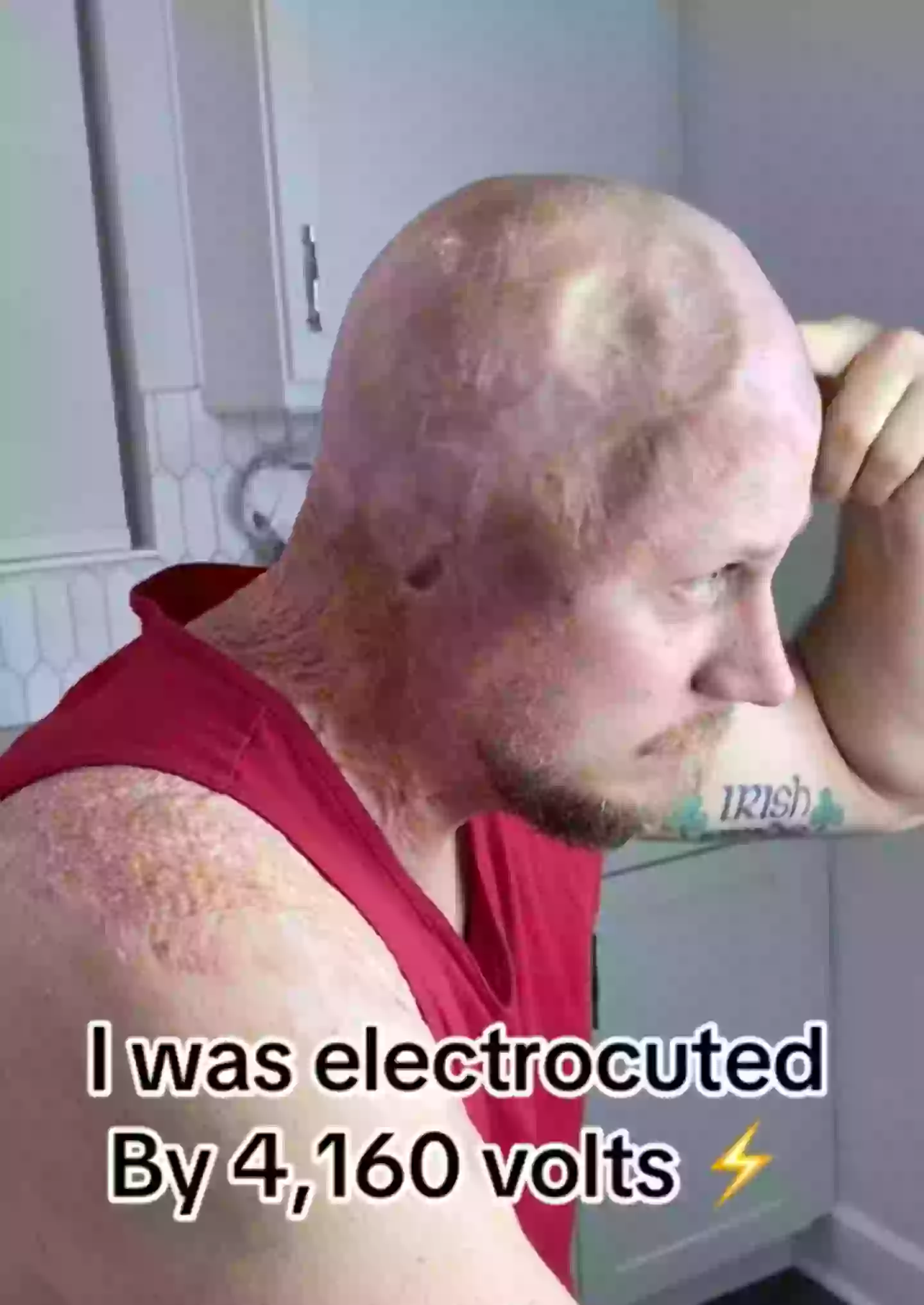 John Pendleton said he 'died twice' when he was electrocuted (TikTok/@johnarcingaheadapparel)