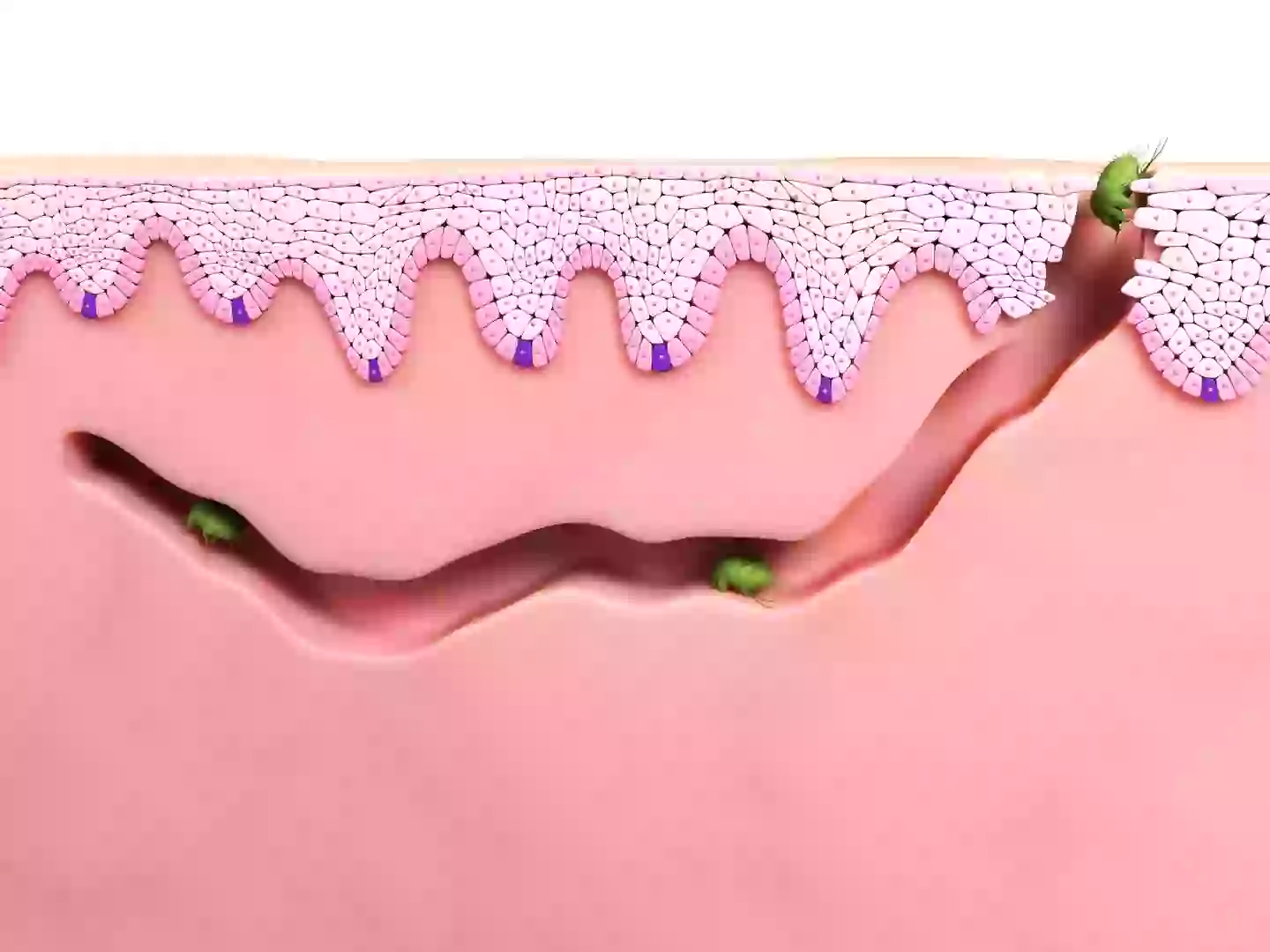 An illustration of what the mites are doing when they burrow under your skin (Getty Stock Images)