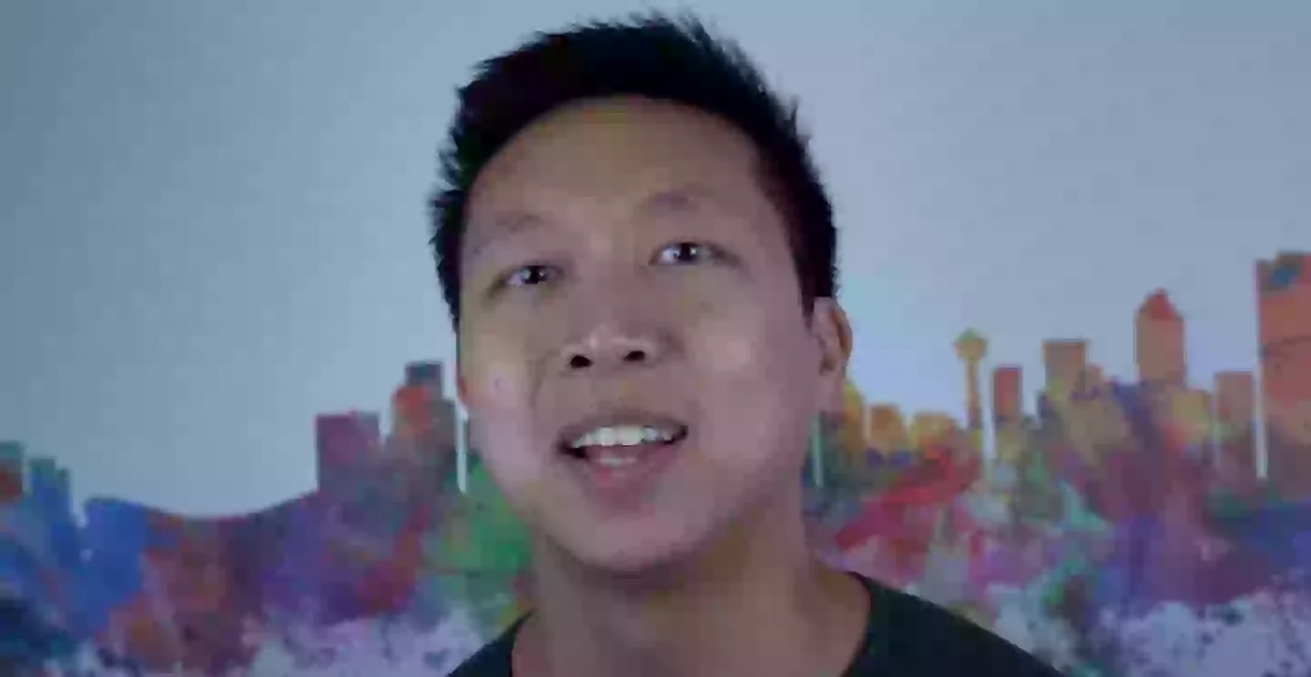 He decided to get work done on just half of his face to show the difference (YouTube/Arlo Medical Injections)