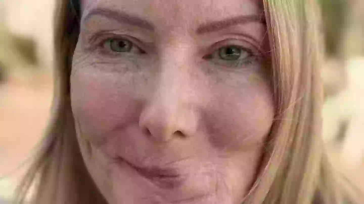 Woman's date ends in horror after she pets stranger's dog and gets lips ripped off