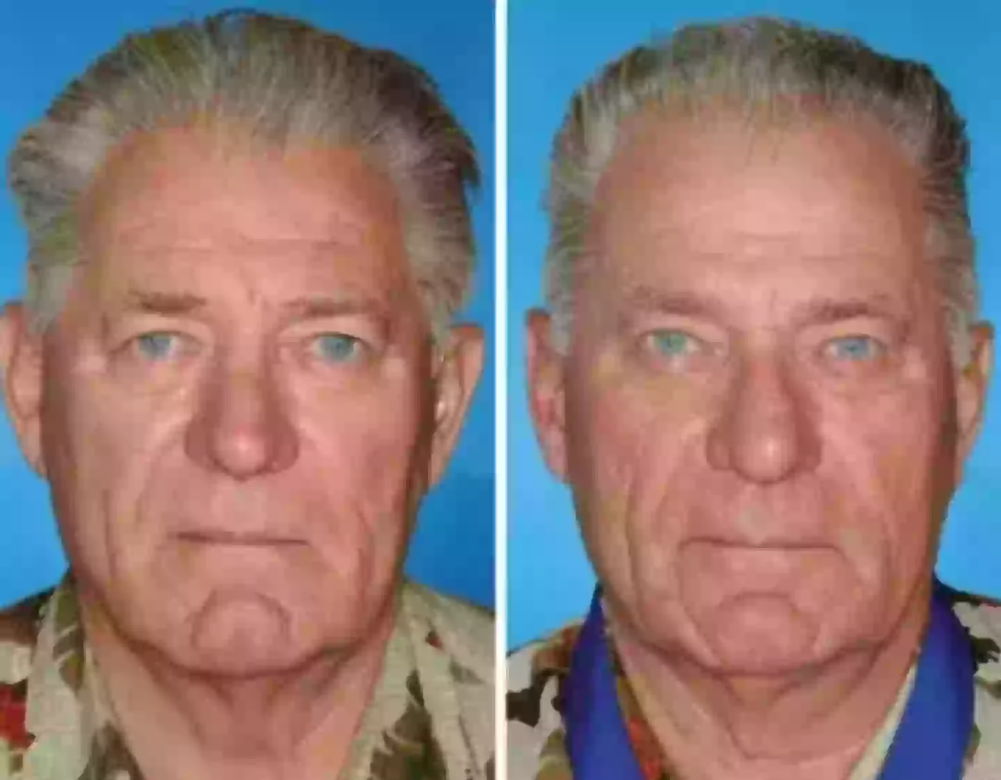 Both men here were smokers, however the right-hand twin smoked for 14 years longer. (American Society of Plastic Surgeons)