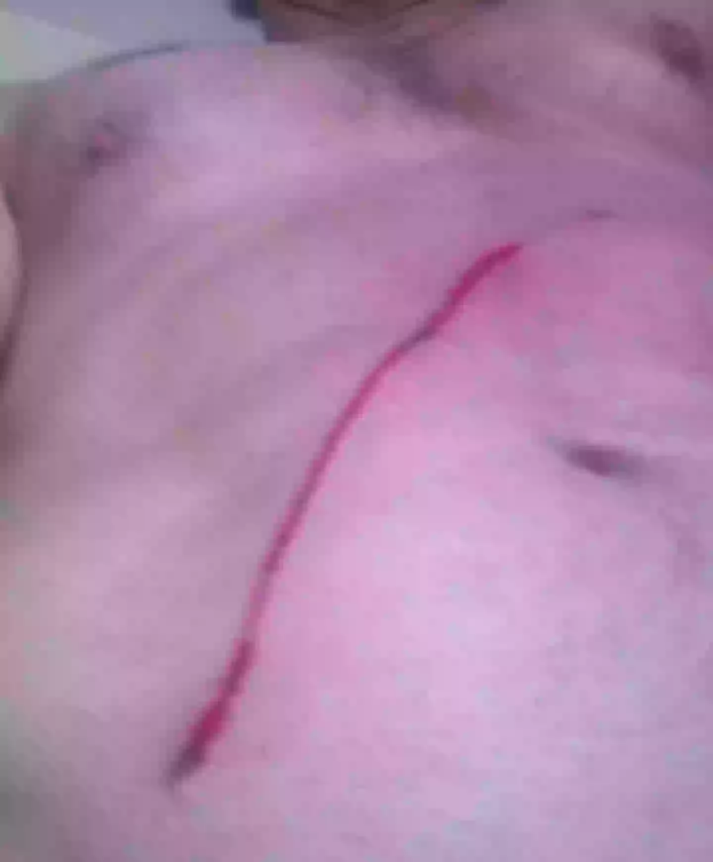 The animal's sharp claws cut through his stomach (Kennedy News and Media)