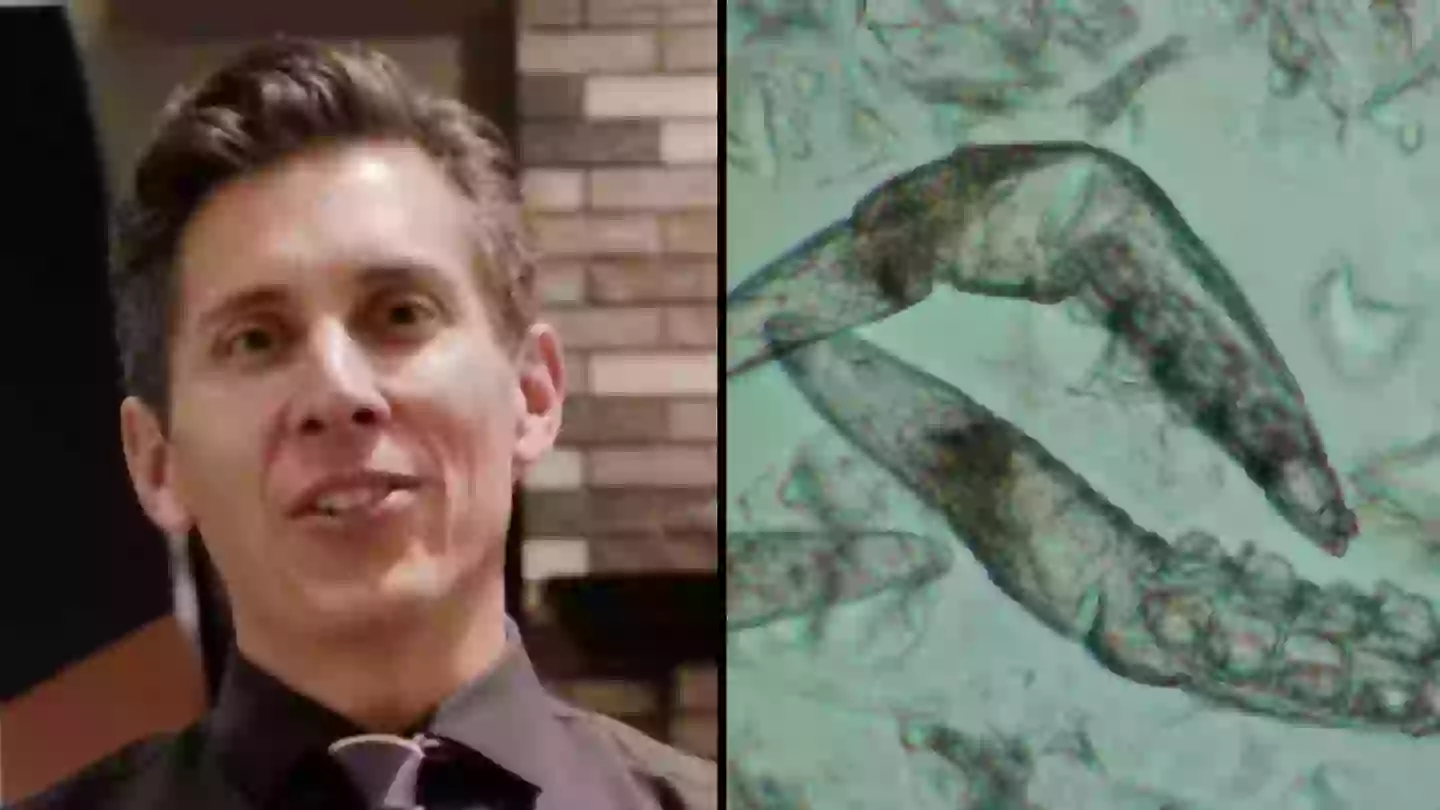 Doctor warns over parasitic eye infection caught by common act that millions do