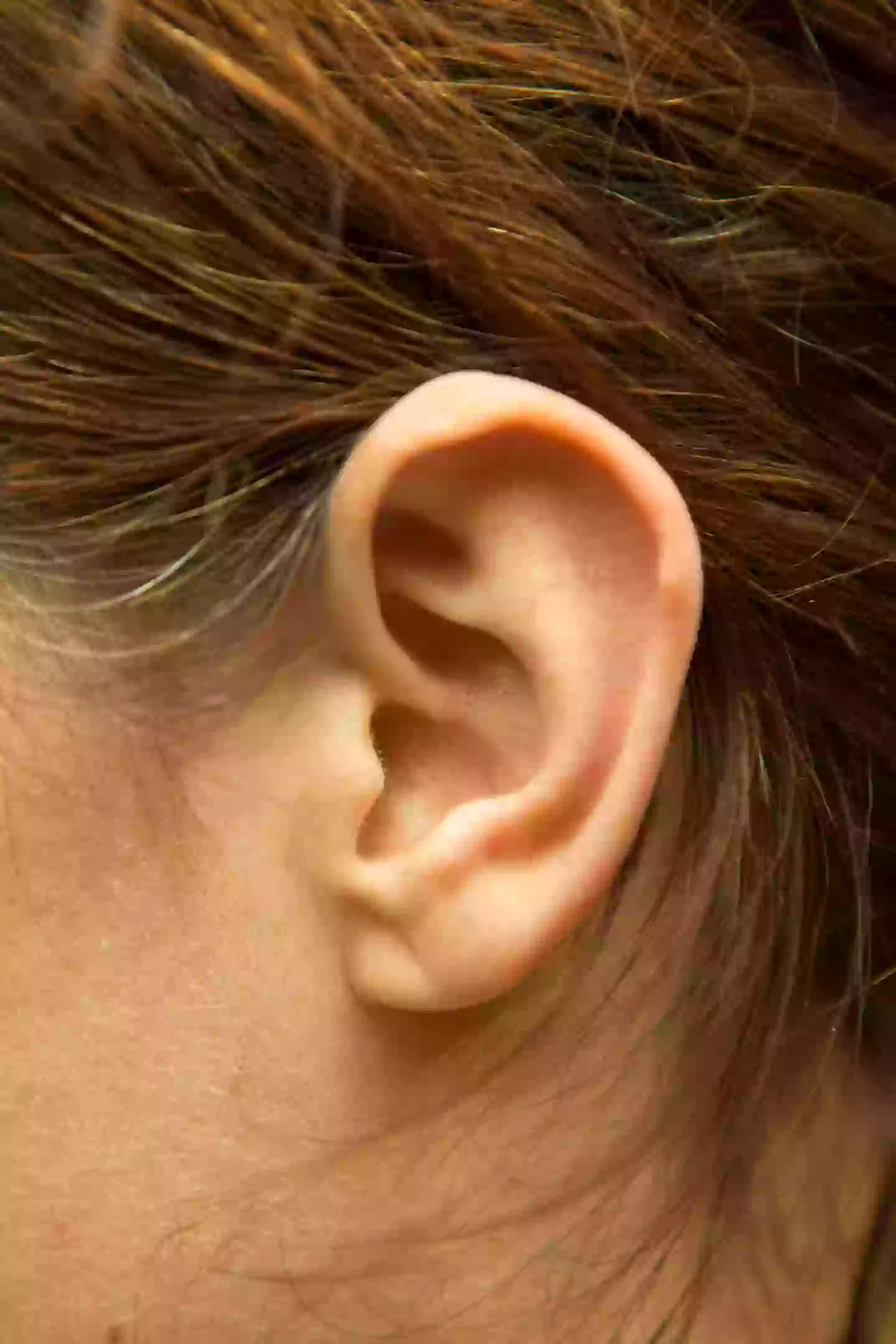 The crease usually goes from the tragus and down towards the far side of the earlobe (Getty Images/Magmos)
