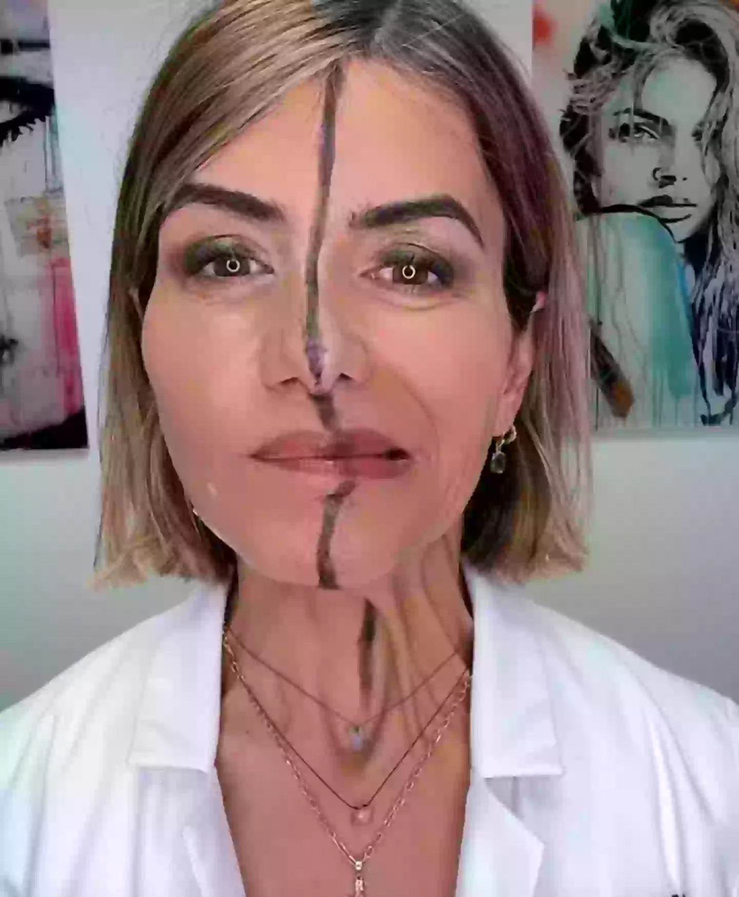 The un-injected side was a lot more mobile than the one which had been blasted with Botox two weeks earlier (Instagram/@drbitafarrell)