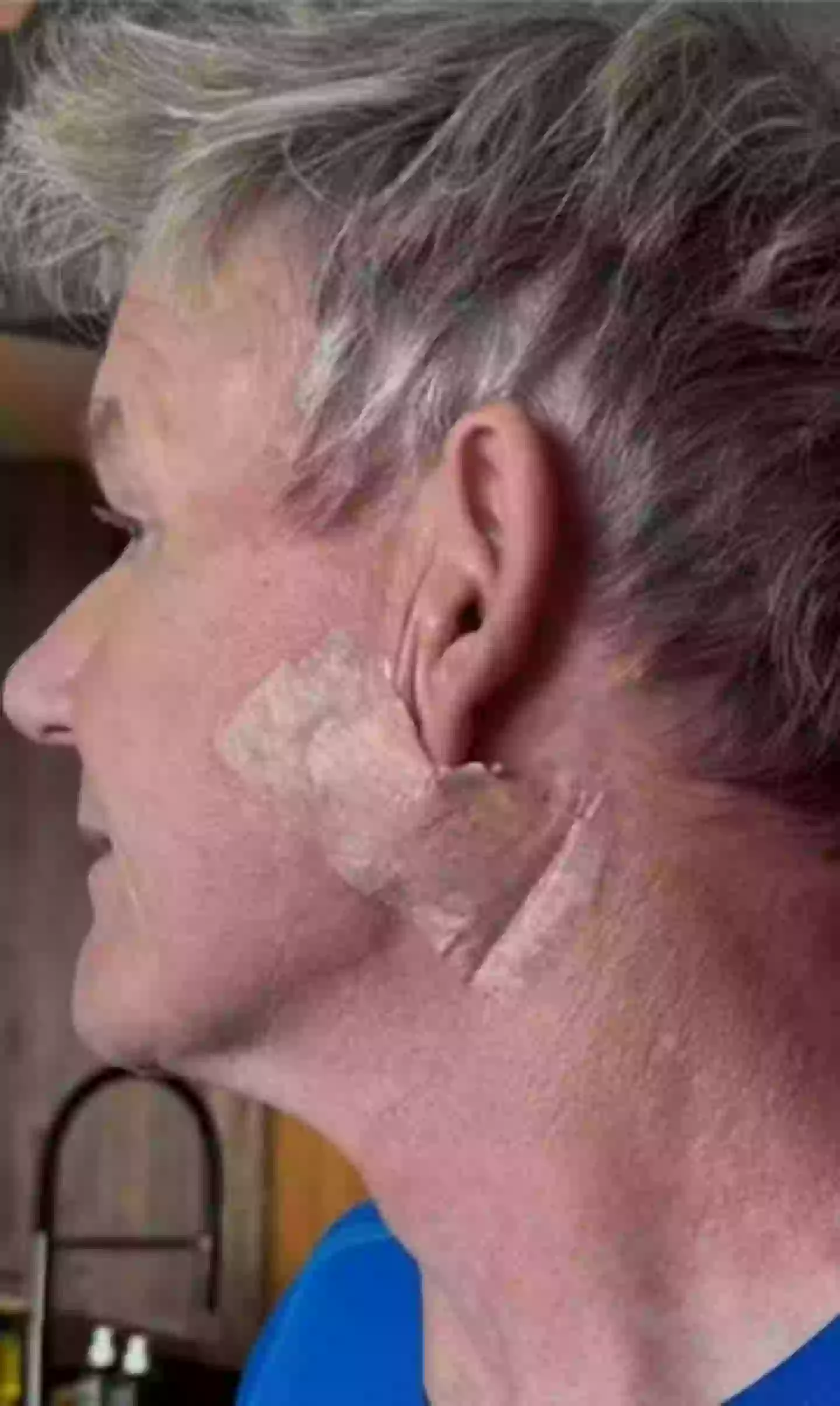 Gordon Ramsay shared a health update on social media (Instagram/@gordongram)