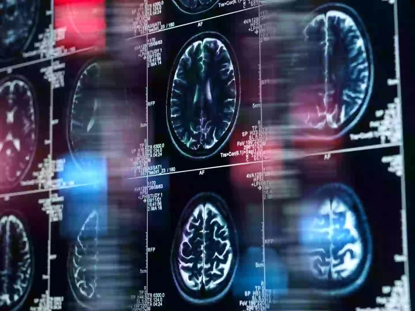 The brain scans revealed a specific pattern in the brain (Getty Stock Image)