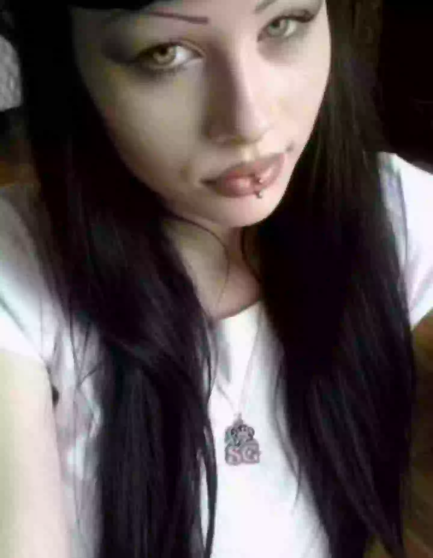 Fetisch Barbie before her various procedures. (Media Drum)