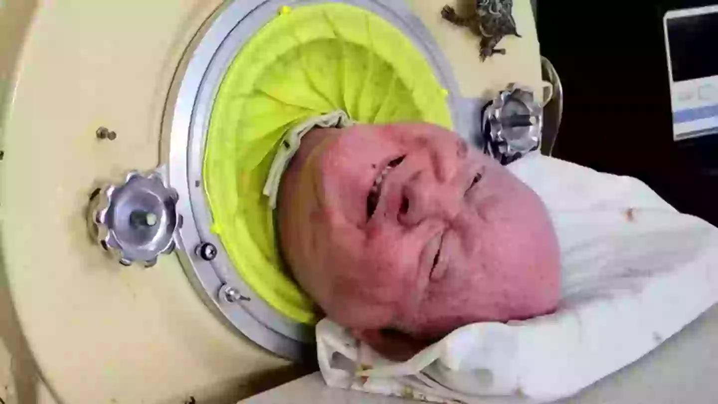 How it was possible for man to survive inside 'iron lung' for 70 years