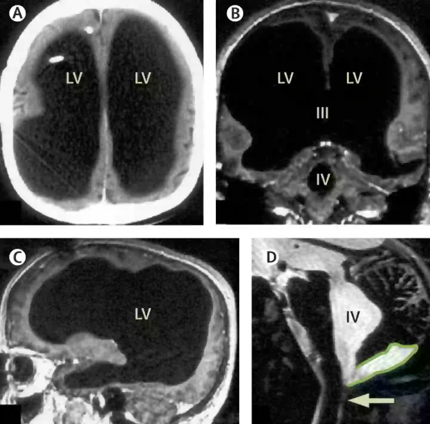 The scans left doctors baffled (The Lancet)