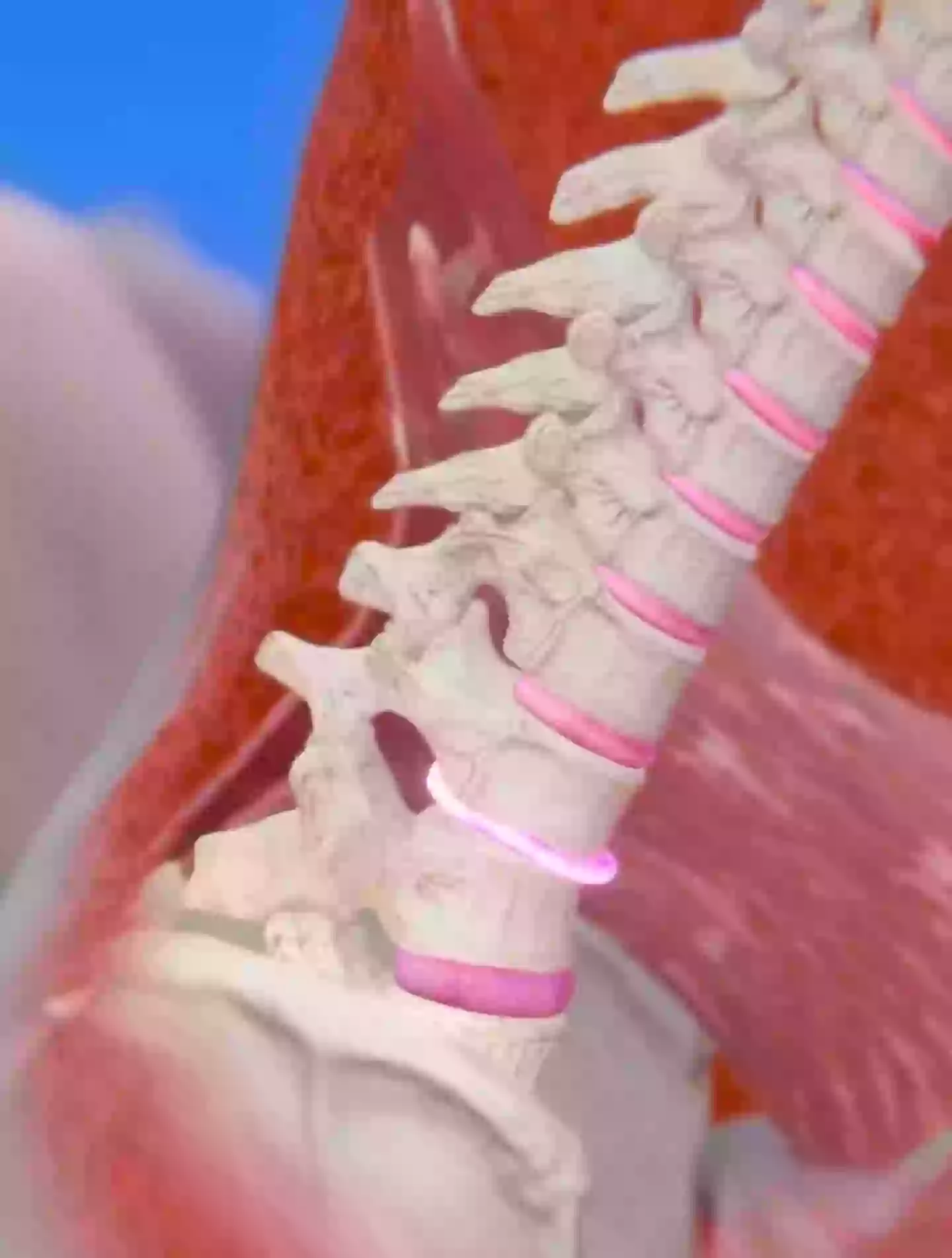 A disc in her spine was ruptured by the sneeze (YouTube/Zack D Films)