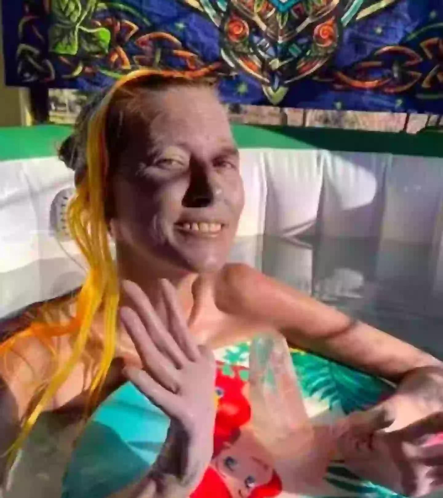 Carlson's body began to change colour (HBO)