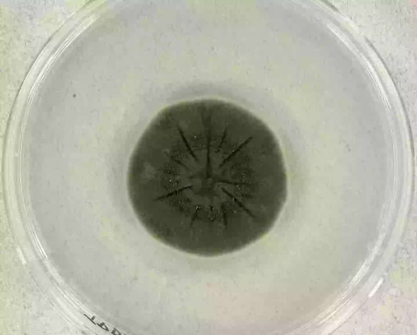 It may look sinister but it could actually be a huge help (Medmyco/Wikimedia)