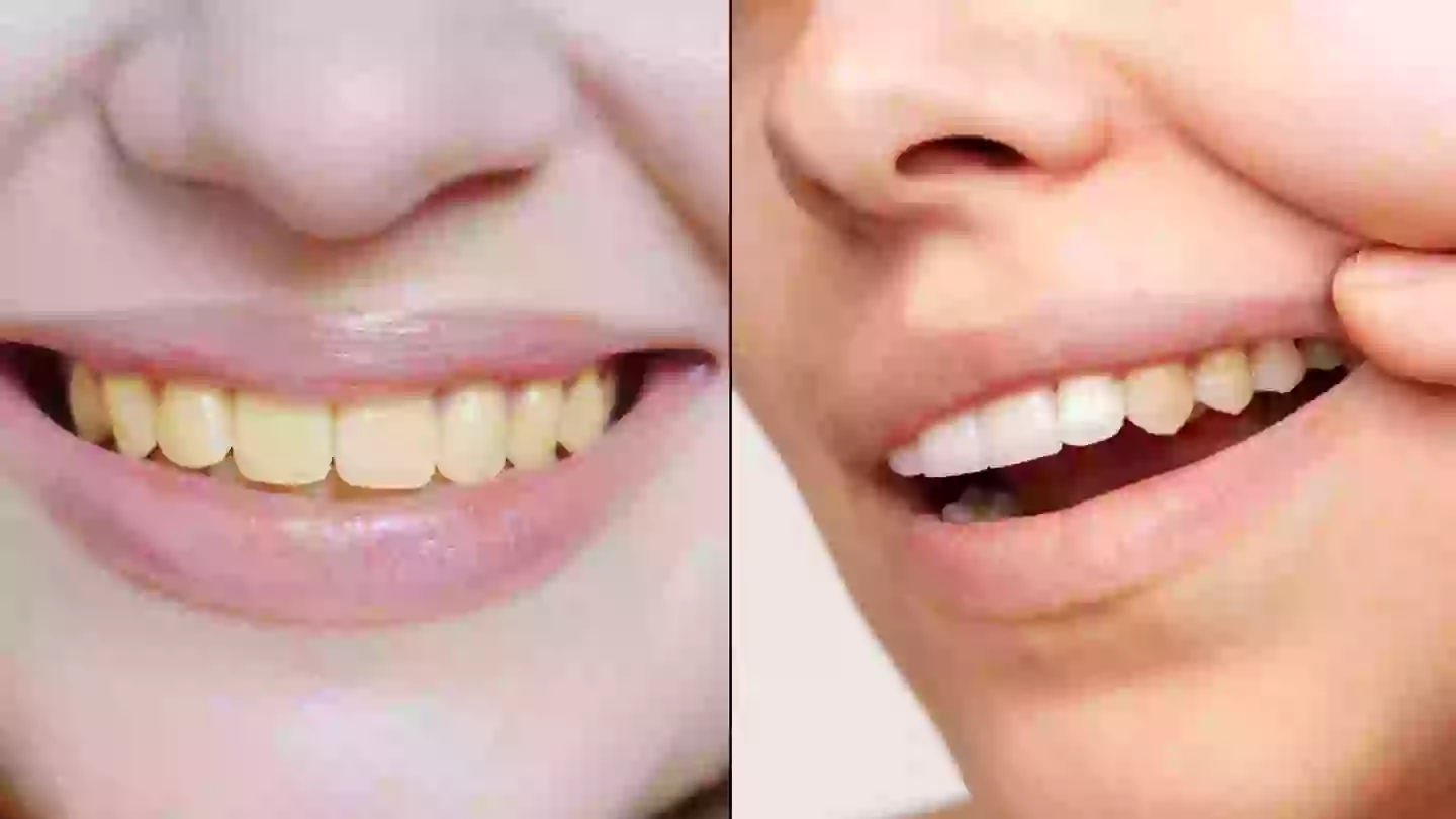 Dentist reveals common Christmas mistake people make that causes their teeth to turn yellow