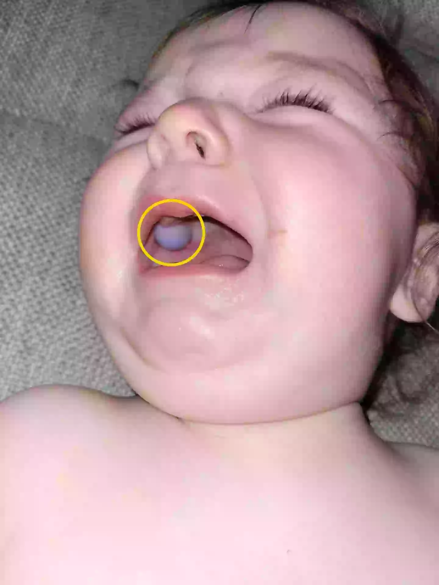 Nine-month-old Max was taken to hospital and doctors suggested the strange object in his mouth might be a tumour (Kennedy News and Media)