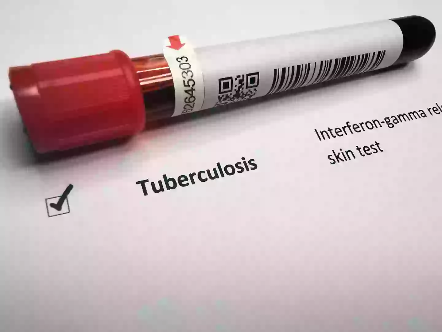 Cases of TB are on the rise, especially among children (Getty Stock Photo)