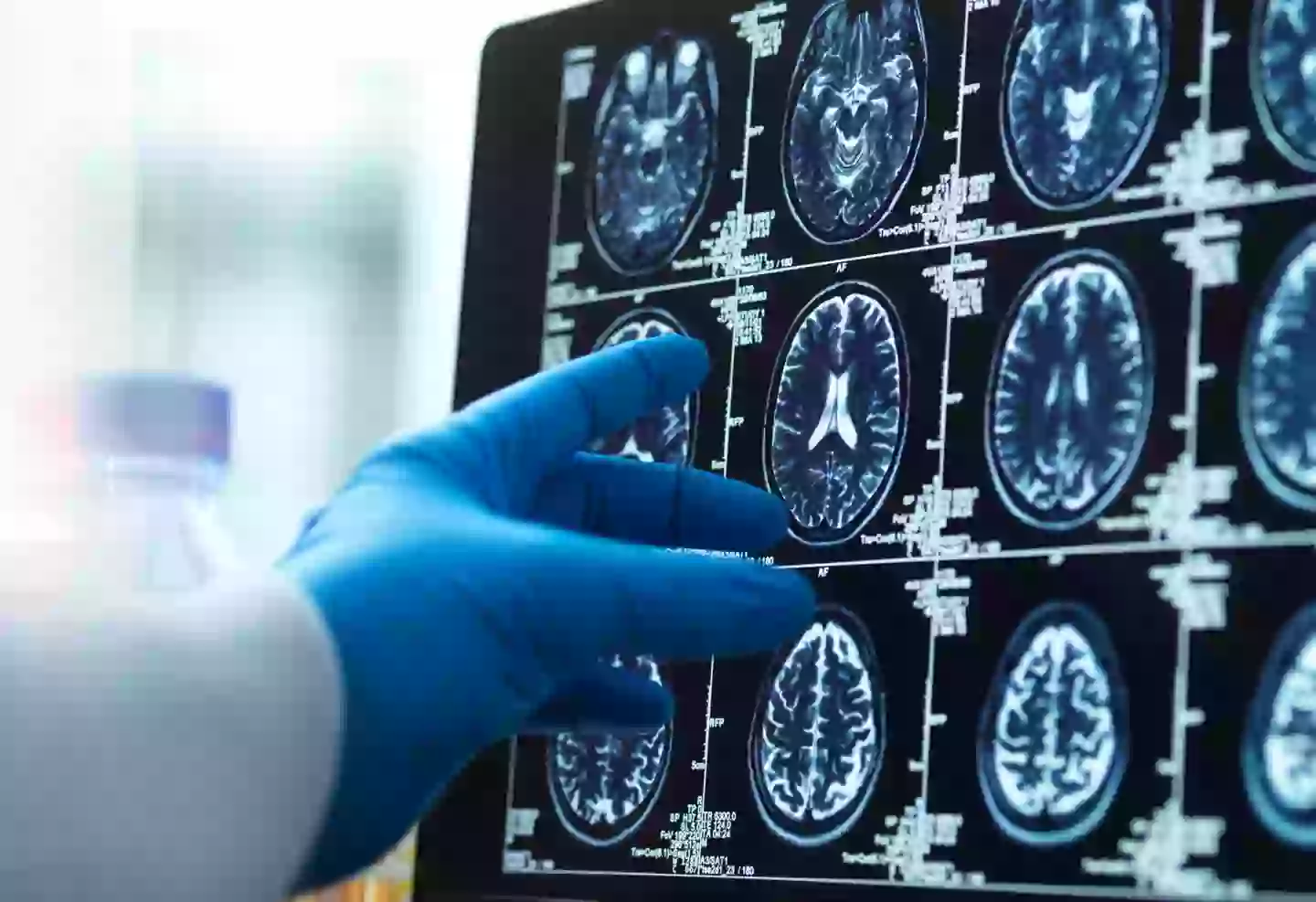 Getting a diagnosis early can be helpful. (Getty Stock)