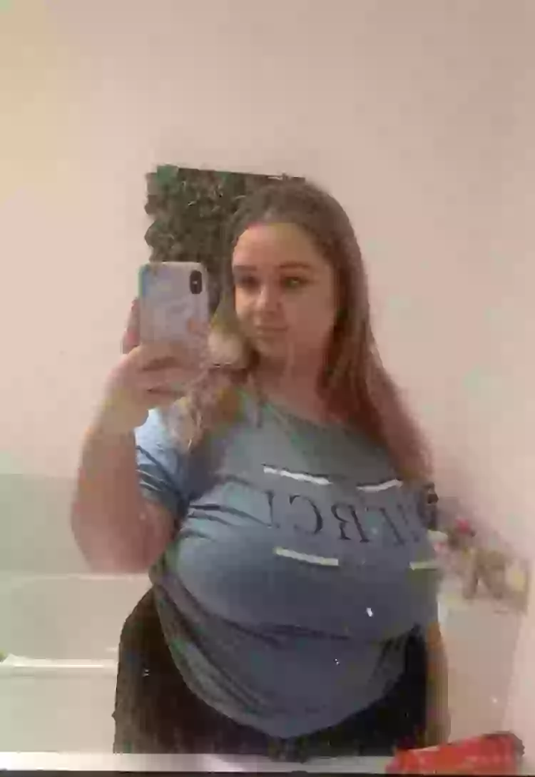 Woman With 44GG sized Boobs Gets Breast Reduction Following Years Of woman-with-44gg-sized-boobs-gets-breast-reduction-following-years-of