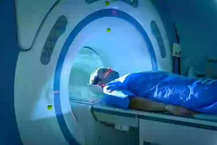 Compressed Brain Man Scientists discover man living a normal life with 90% of his brain missing