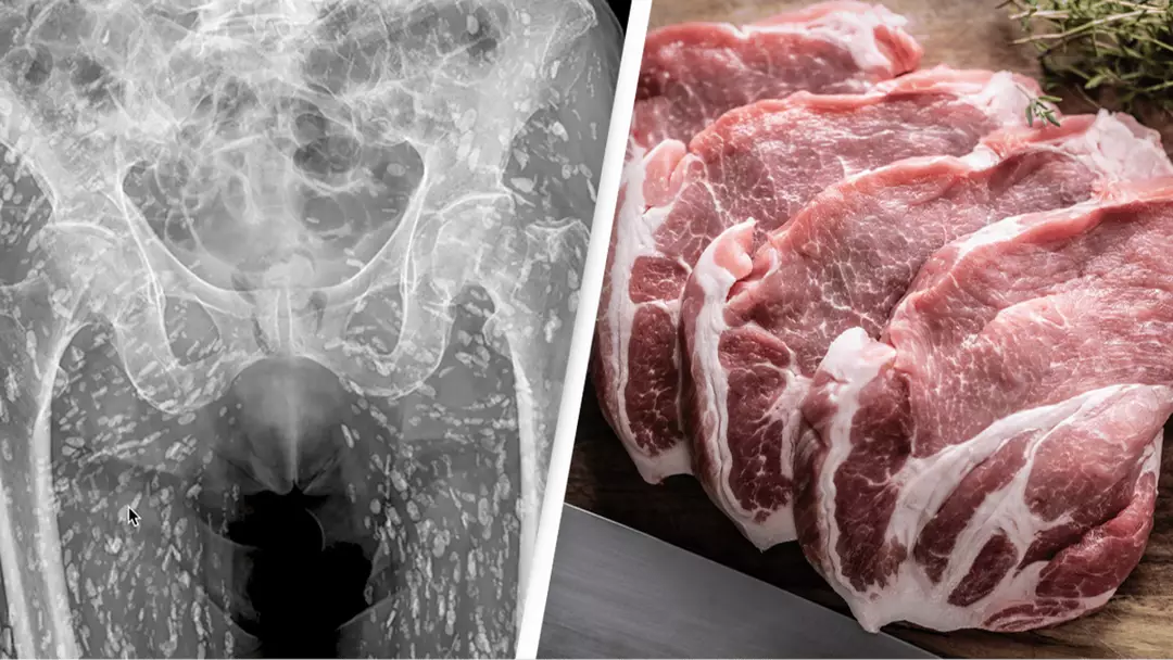 ER doctor breaks down horrifying scans that show parasite-infested body ...
