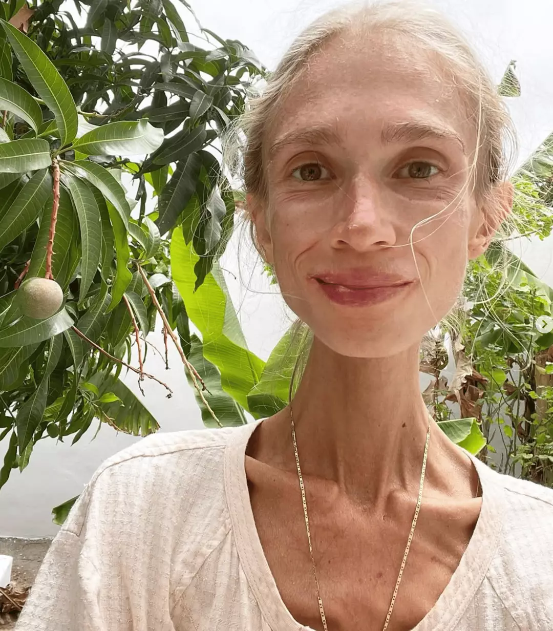 Tragic Story Woman Dies From Starvation After Following Extreme tragic-story-woman-dies-from-starvation-after-following-extreme